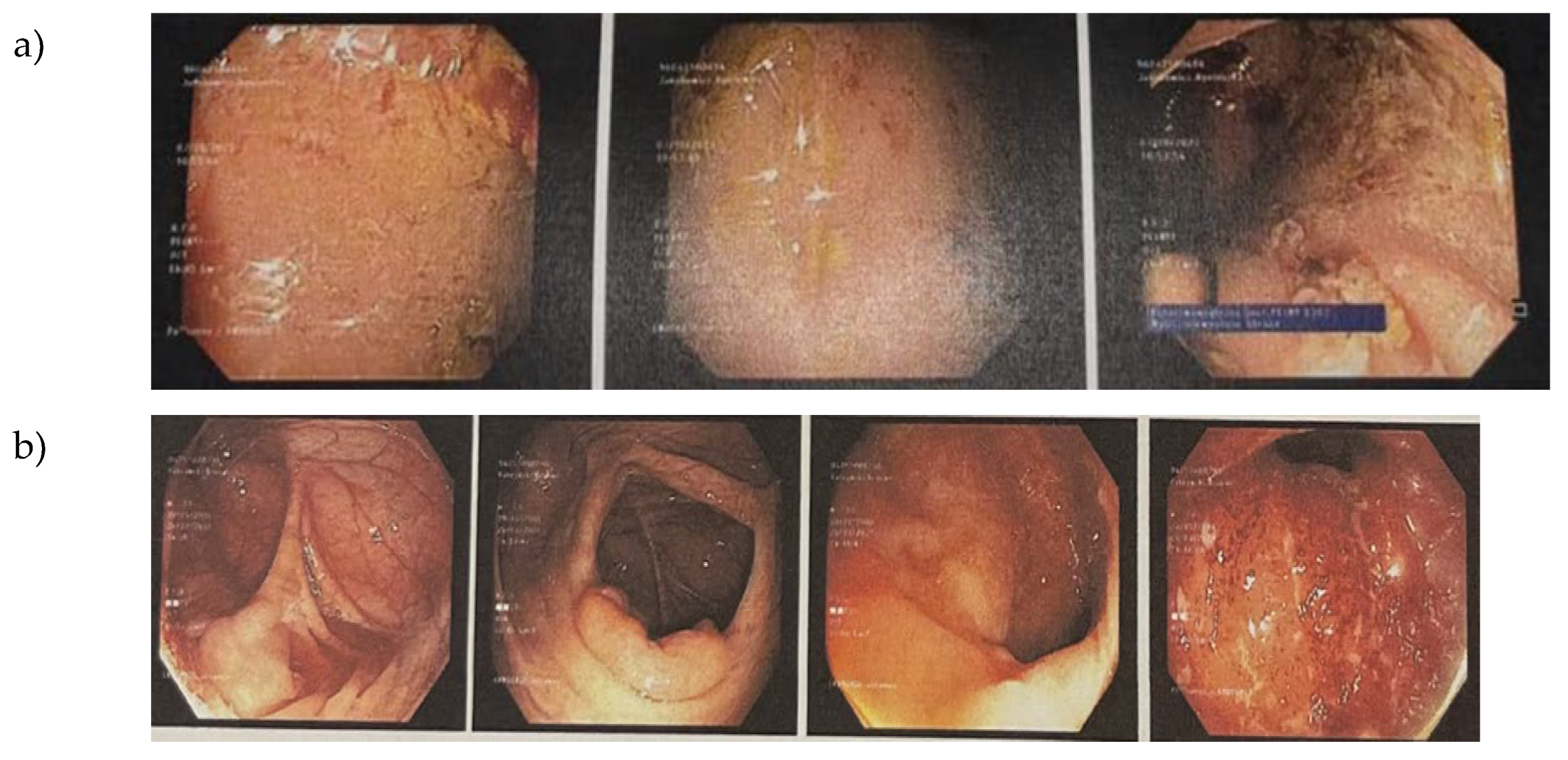Preprints 182244 g002