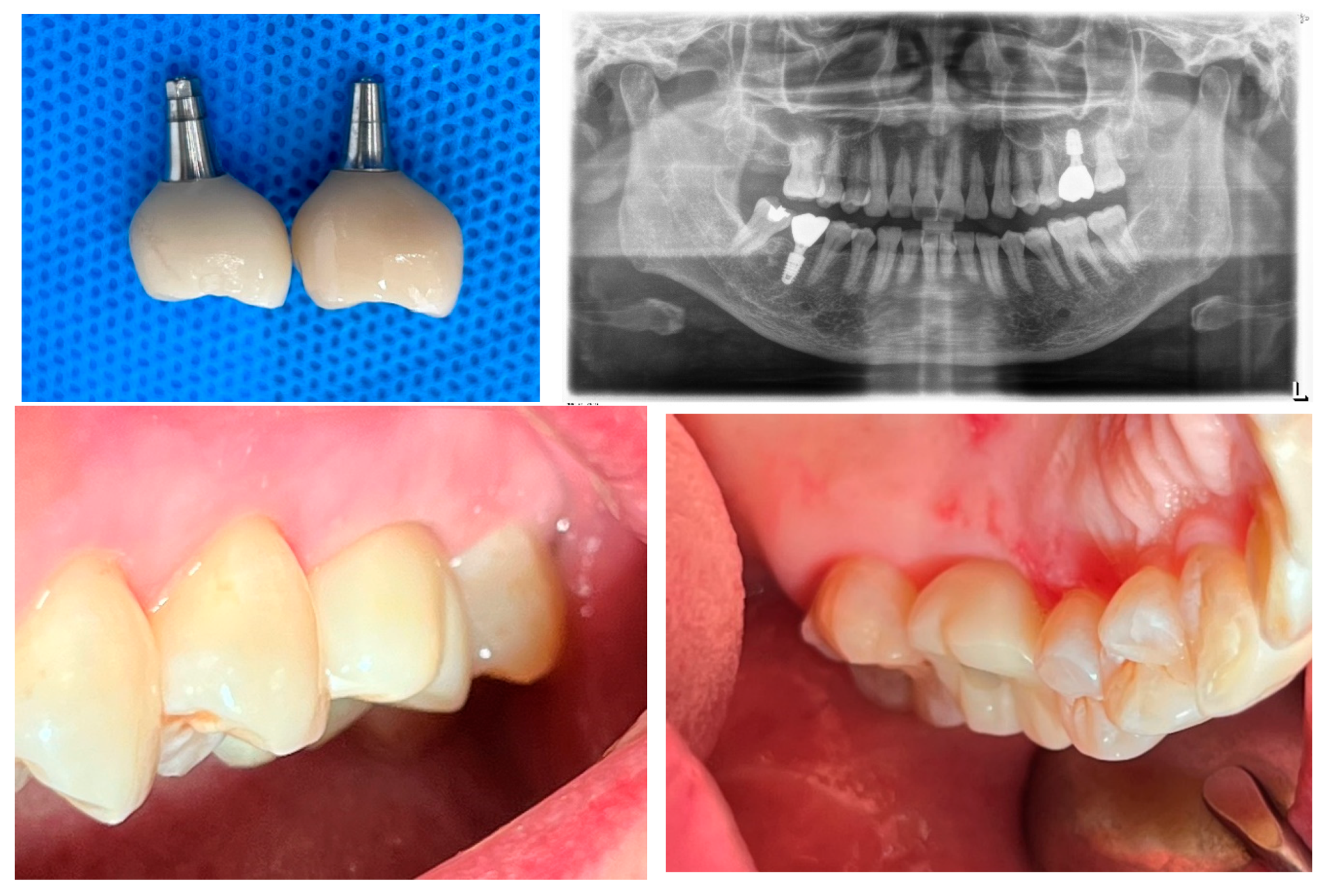 Preprints 151394 g006