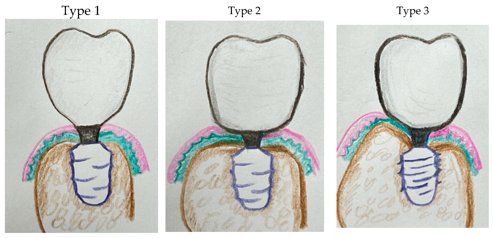 Preprints 151394 g014