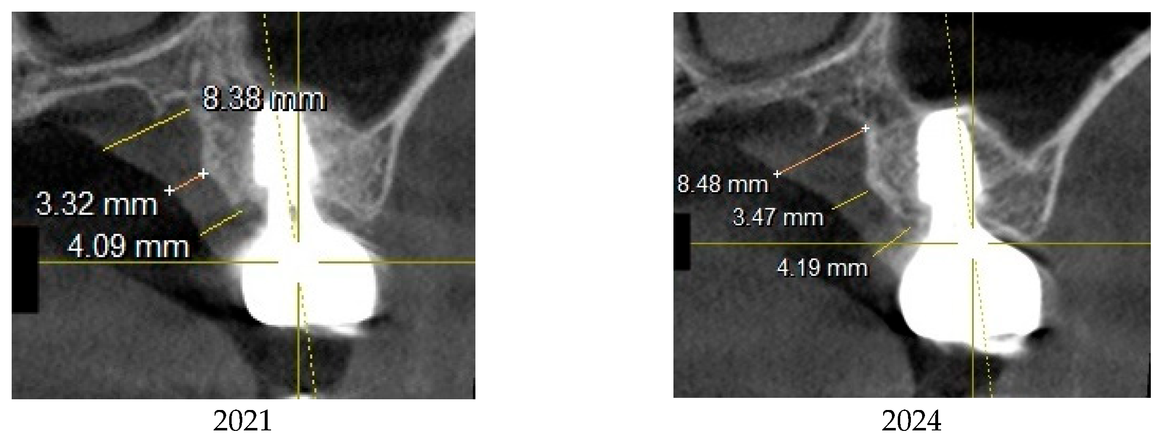 Preprints 151394 g015