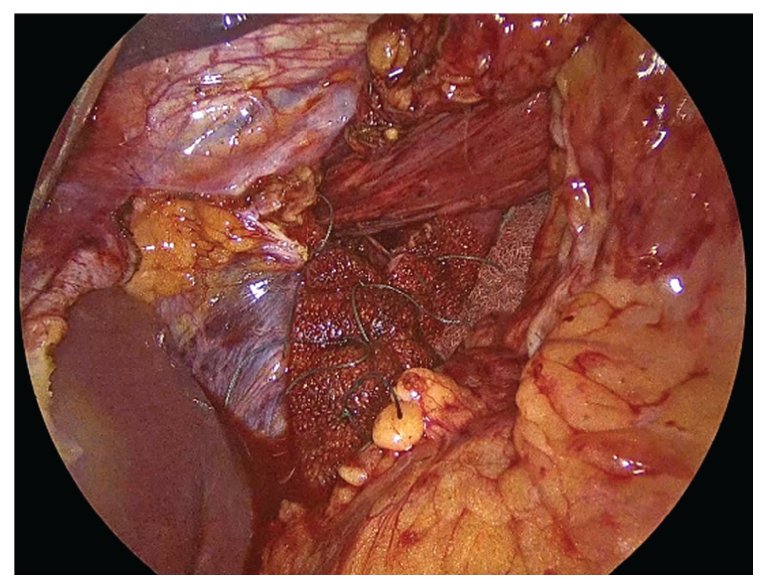 Preprints 183224 g004