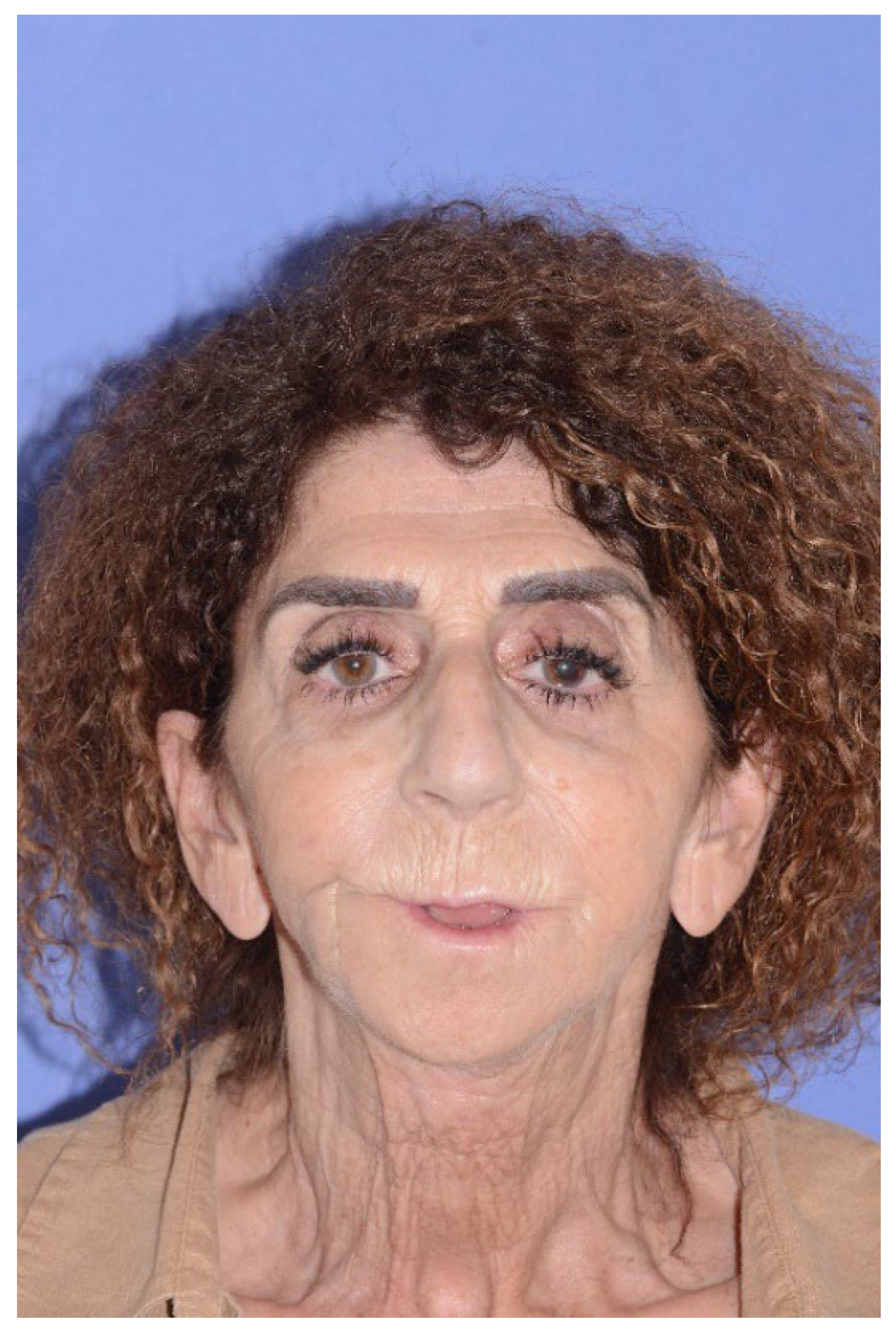 Preprints 155210 g005