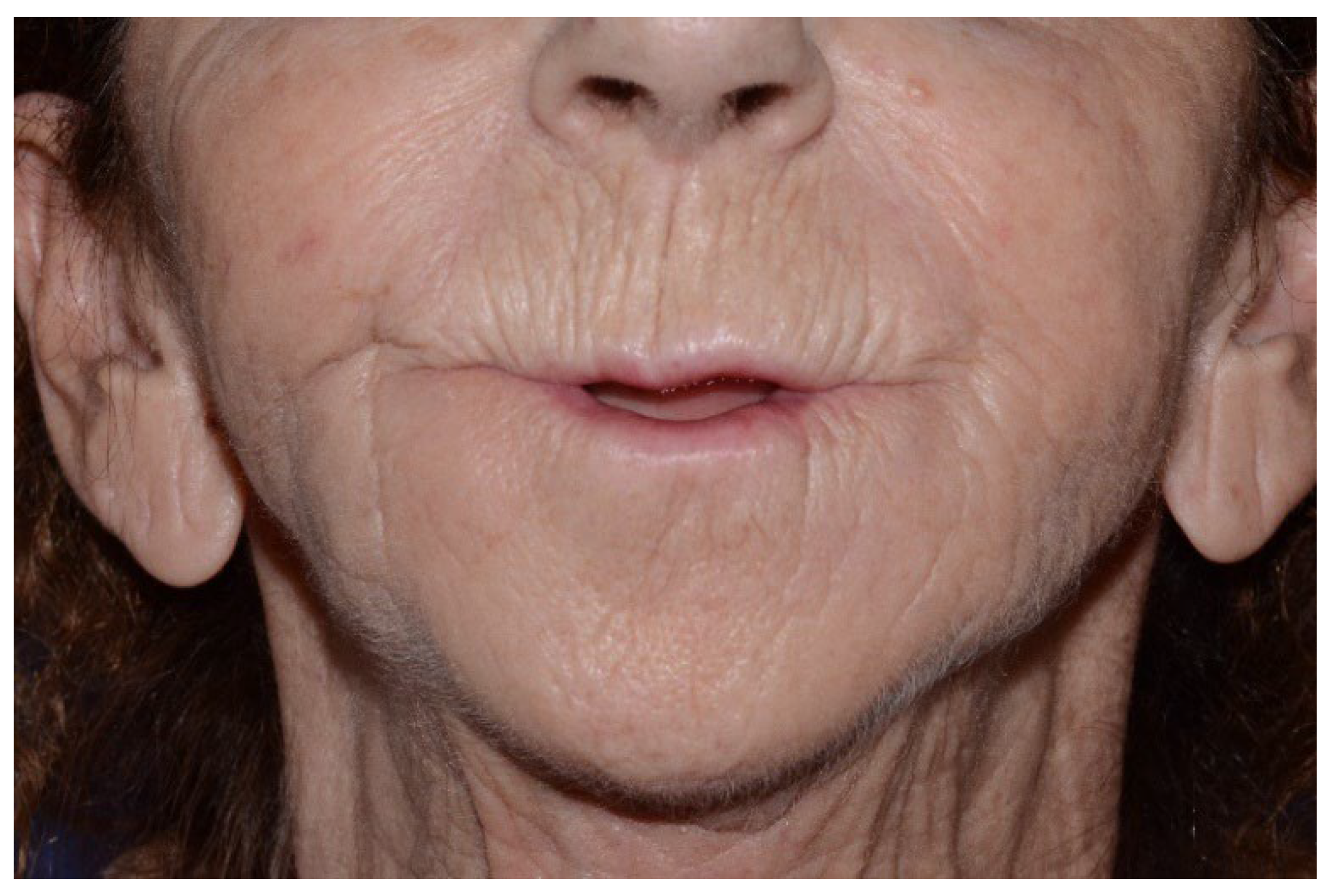 Preprints 155210 g006