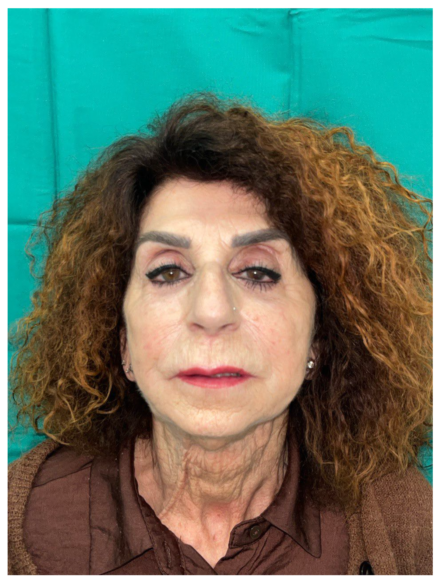 Preprints 155210 g010