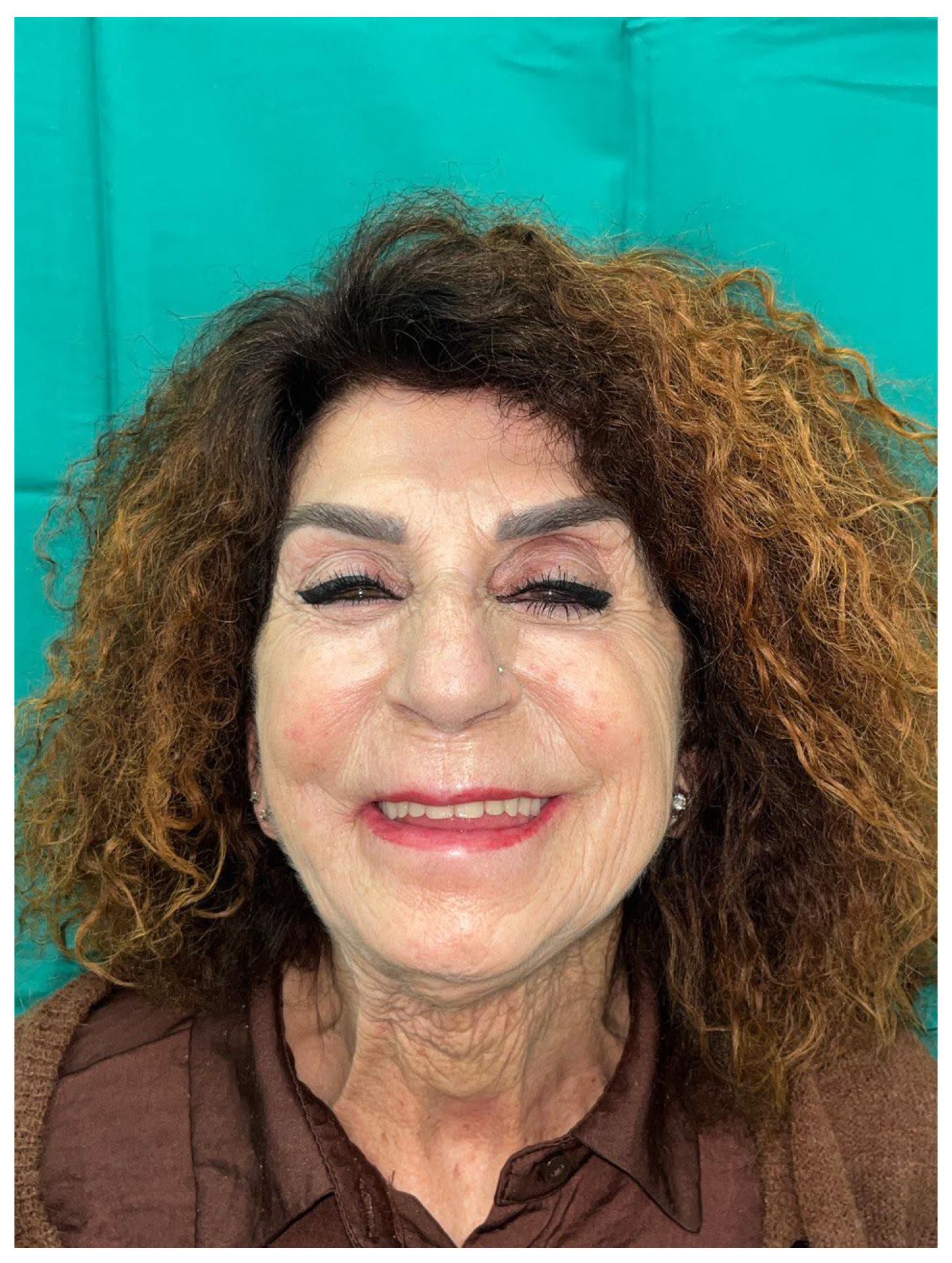 Preprints 155210 g011