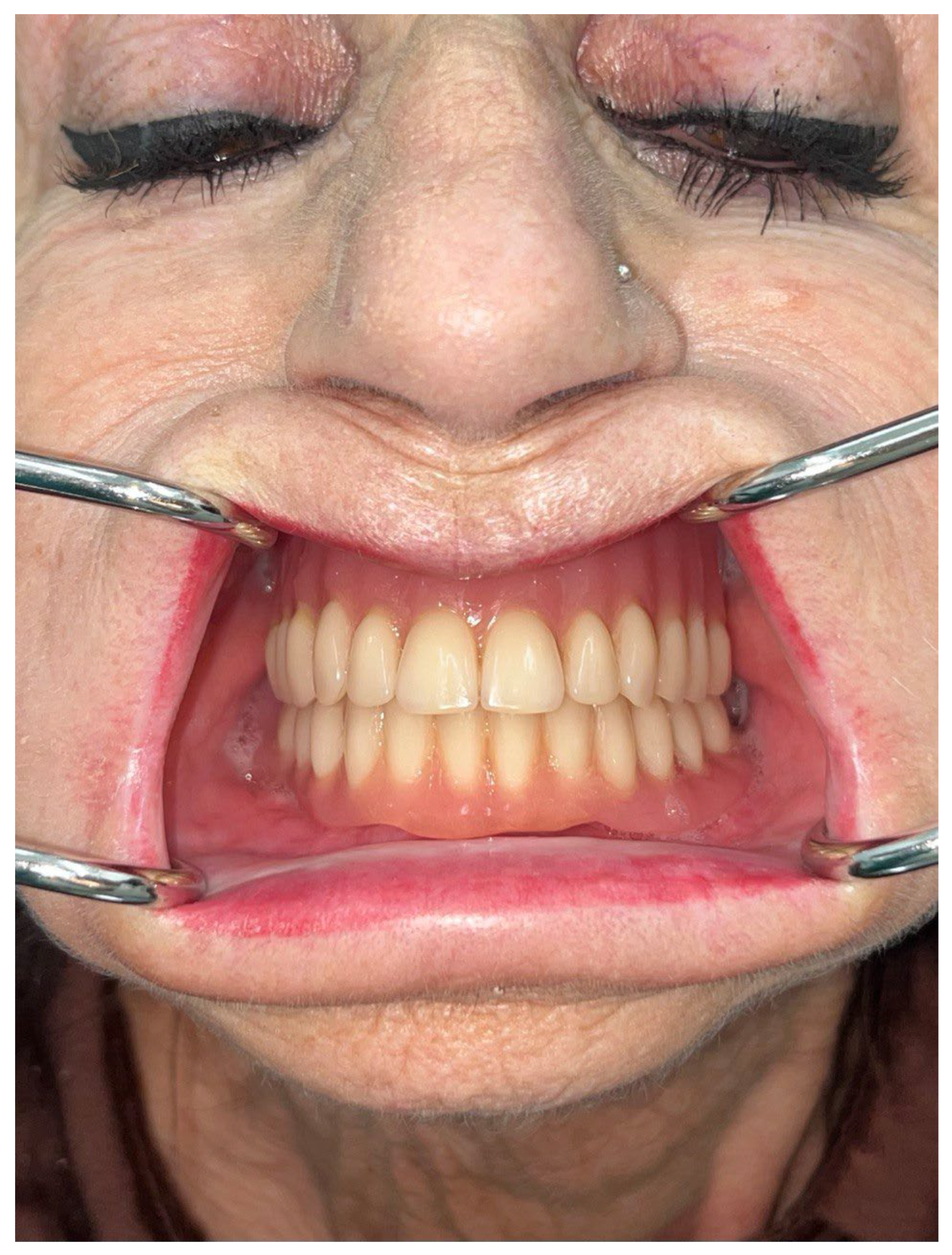 Preprints 155210 g012