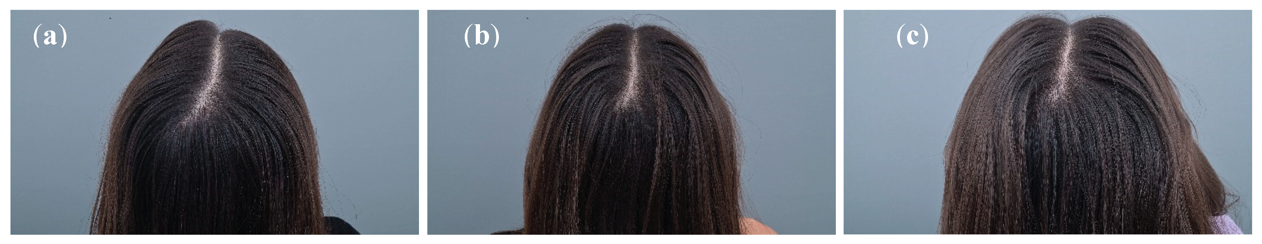 Preprints 171414 g005