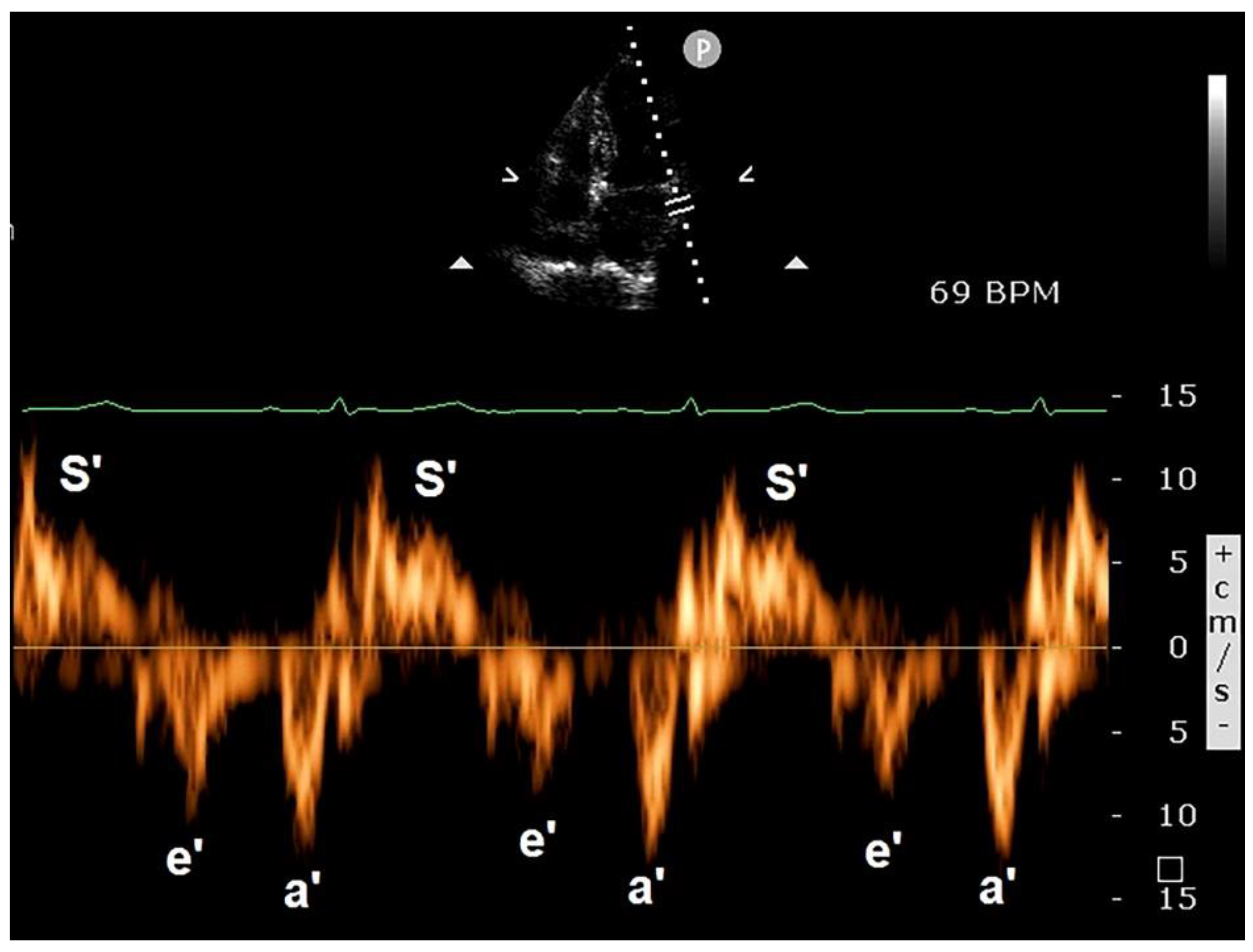 Preprints 143362 g005