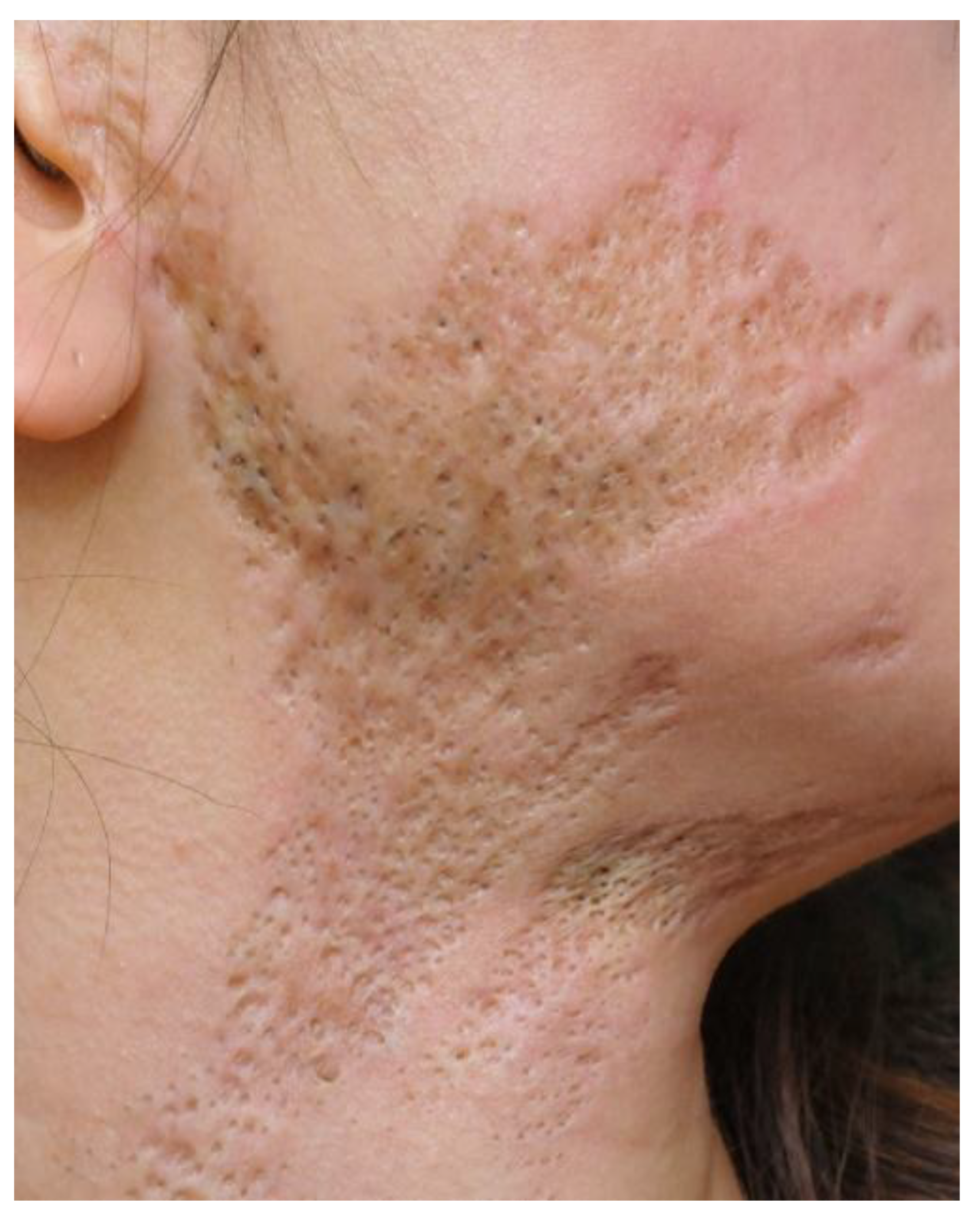 Preprints 166644 g004