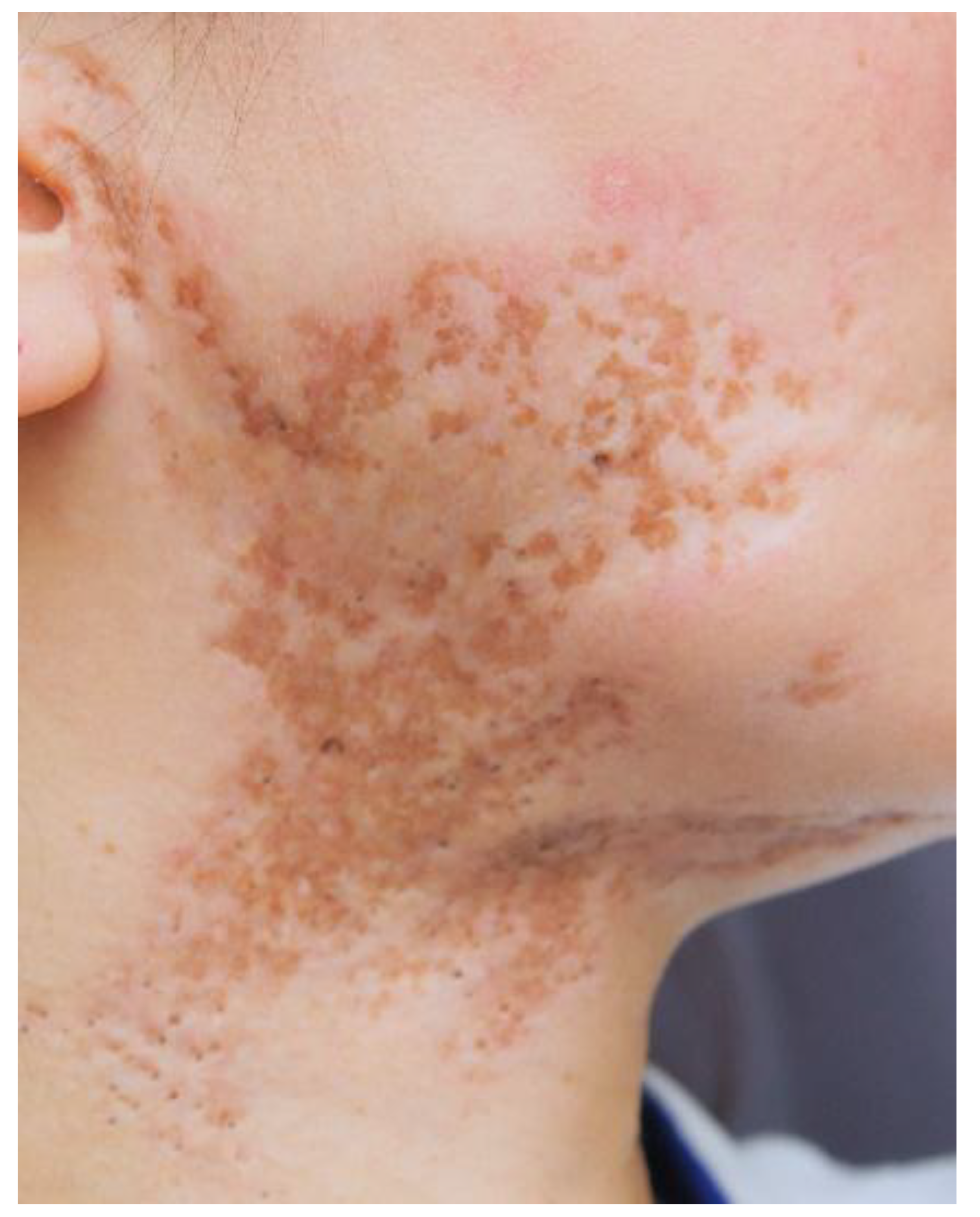 Preprints 166644 g006