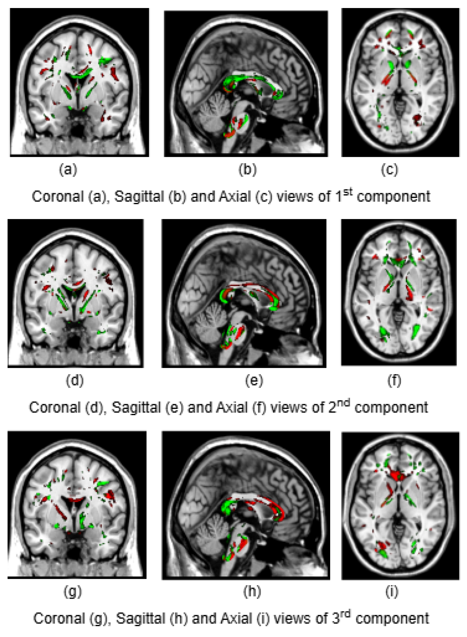 Preprints 148029 g004