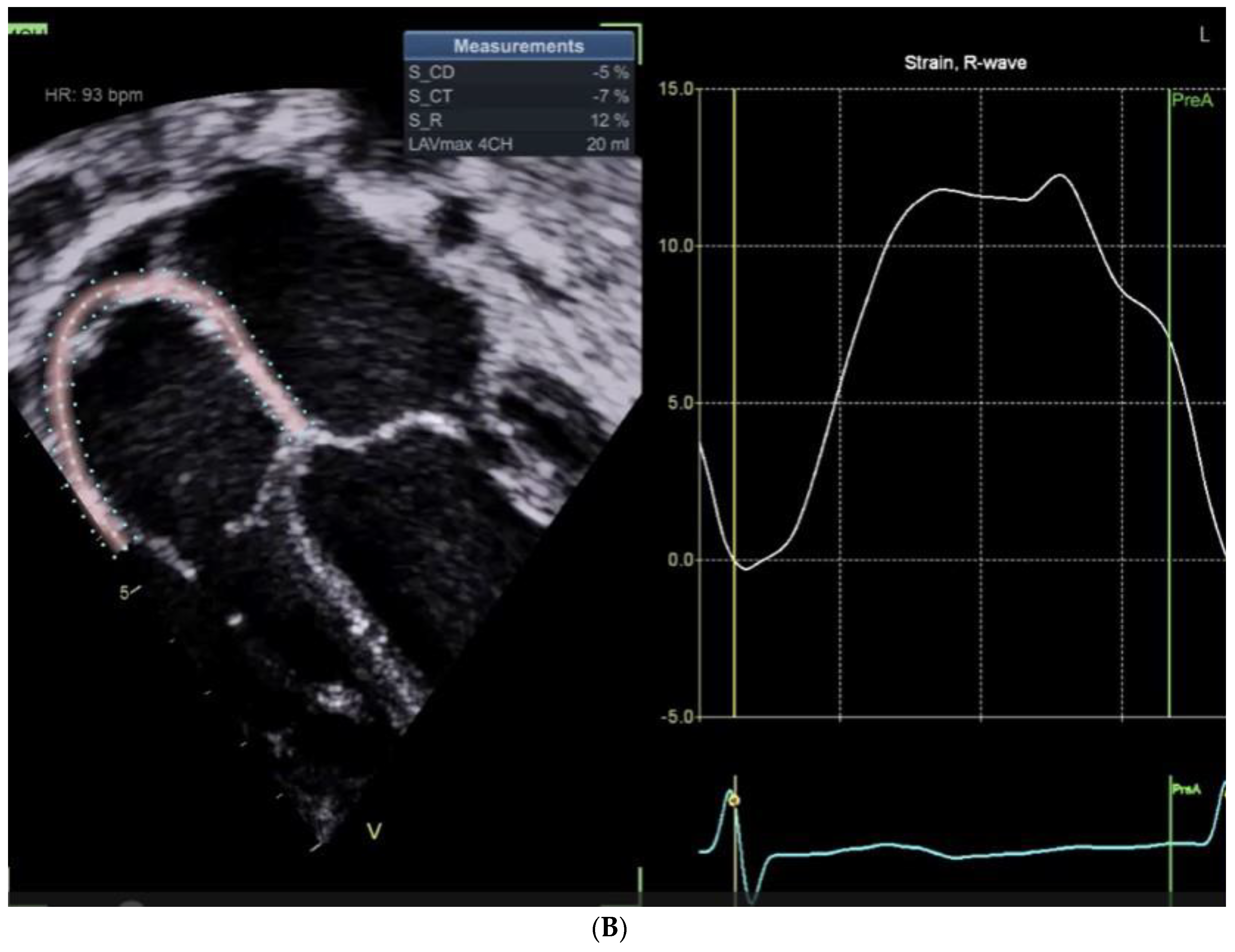 Preprints 138393 g001b