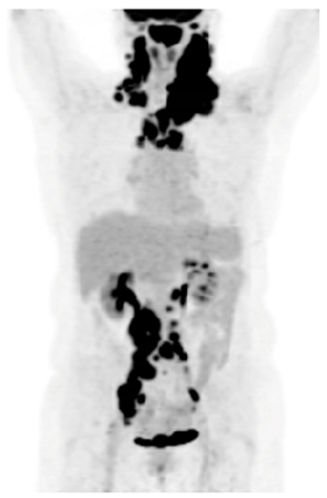 Preprints 147489 i001