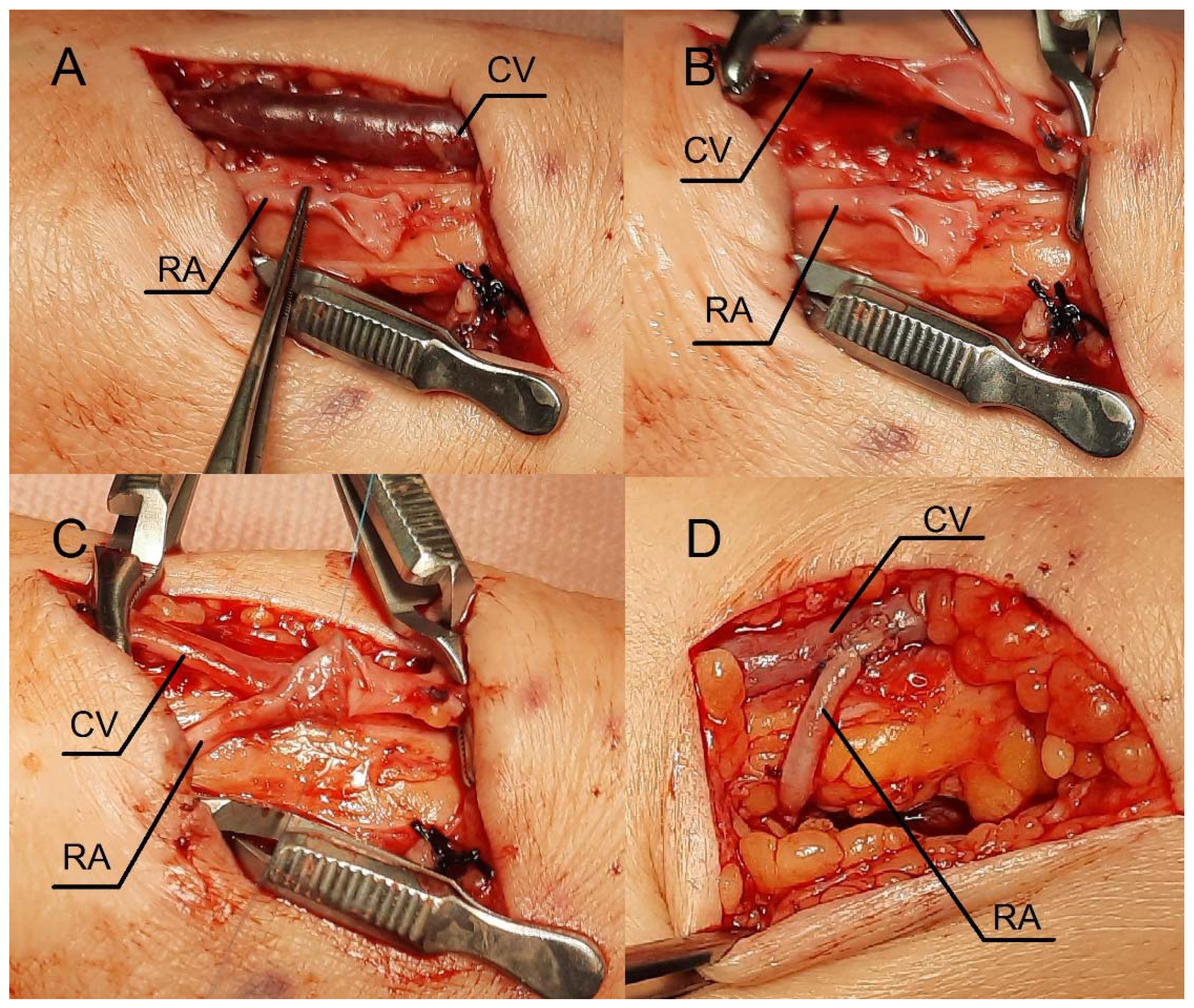 Preprints 85062 g004