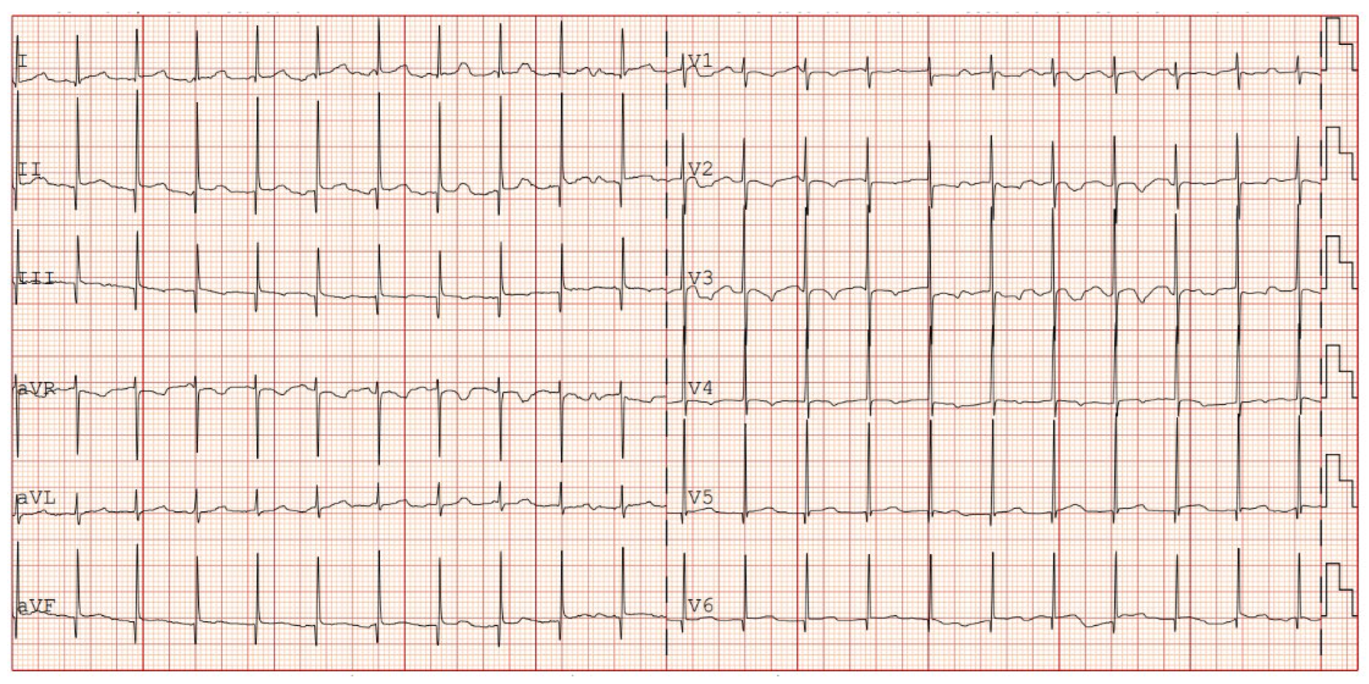Preprints 159278 g004