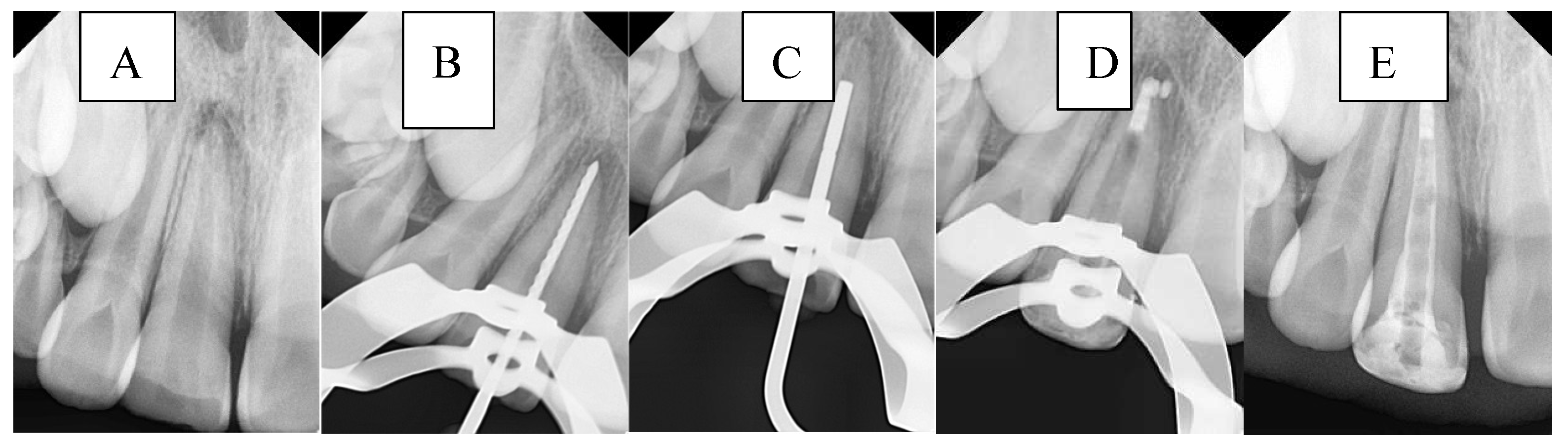 Preprints 177802 g004