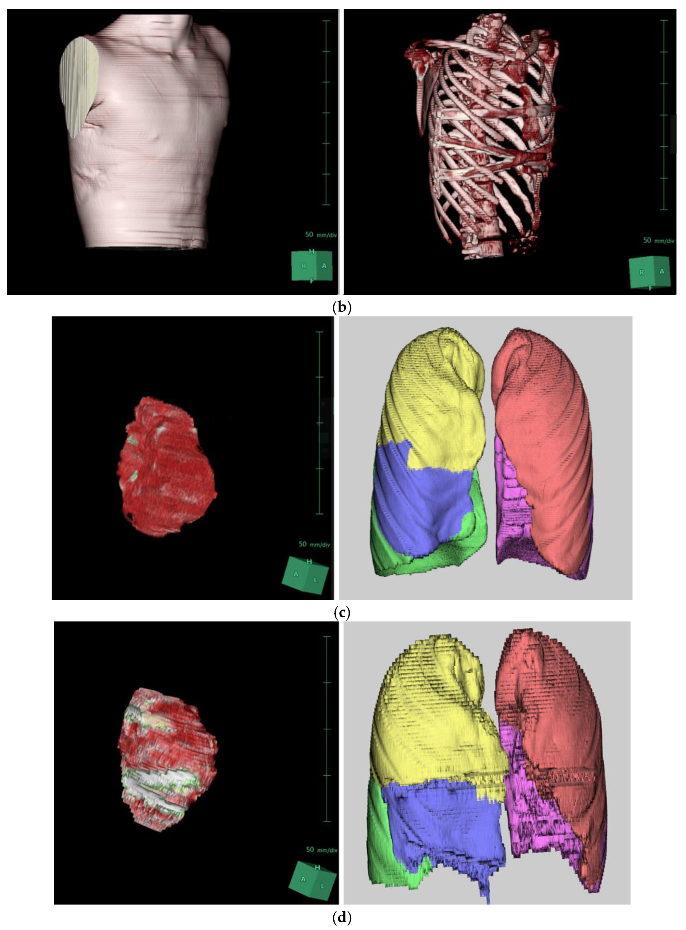 Preprints 159645 g002b
