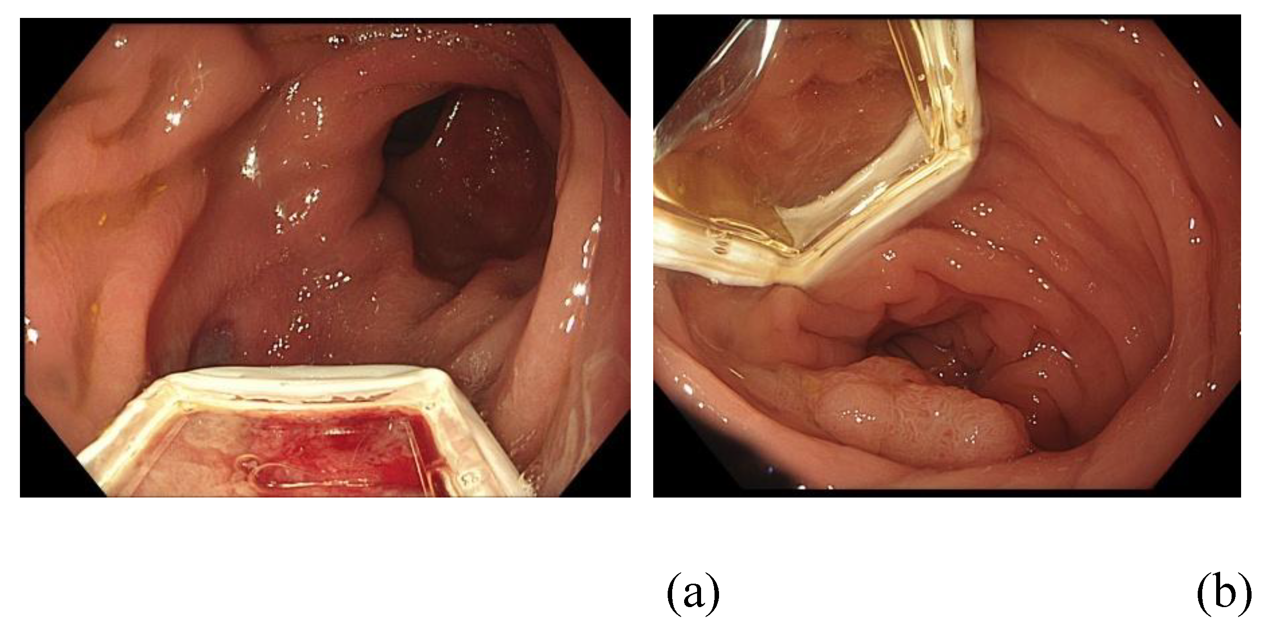 Preprints 178740 g004