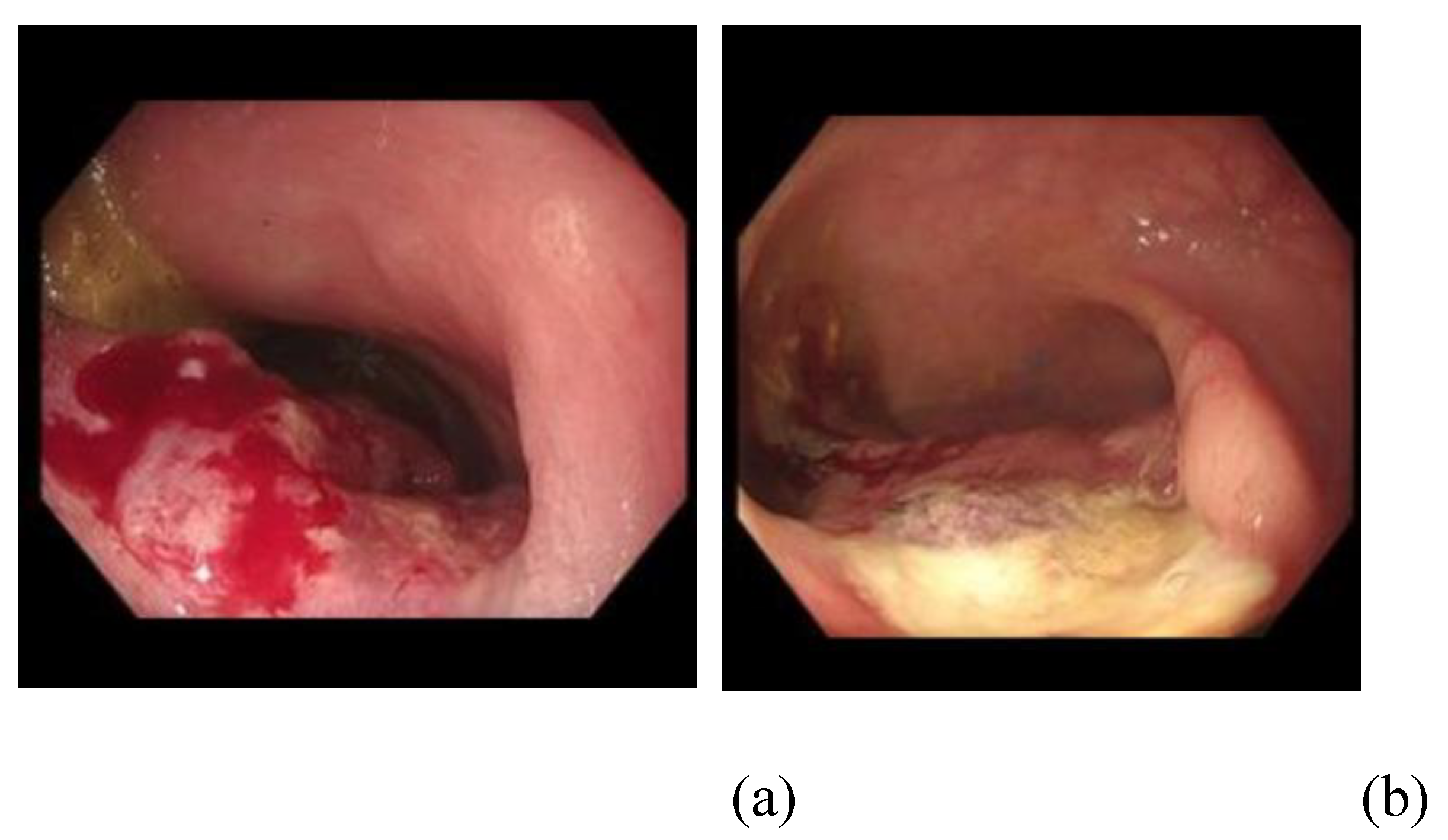 Preprints 178740 g005