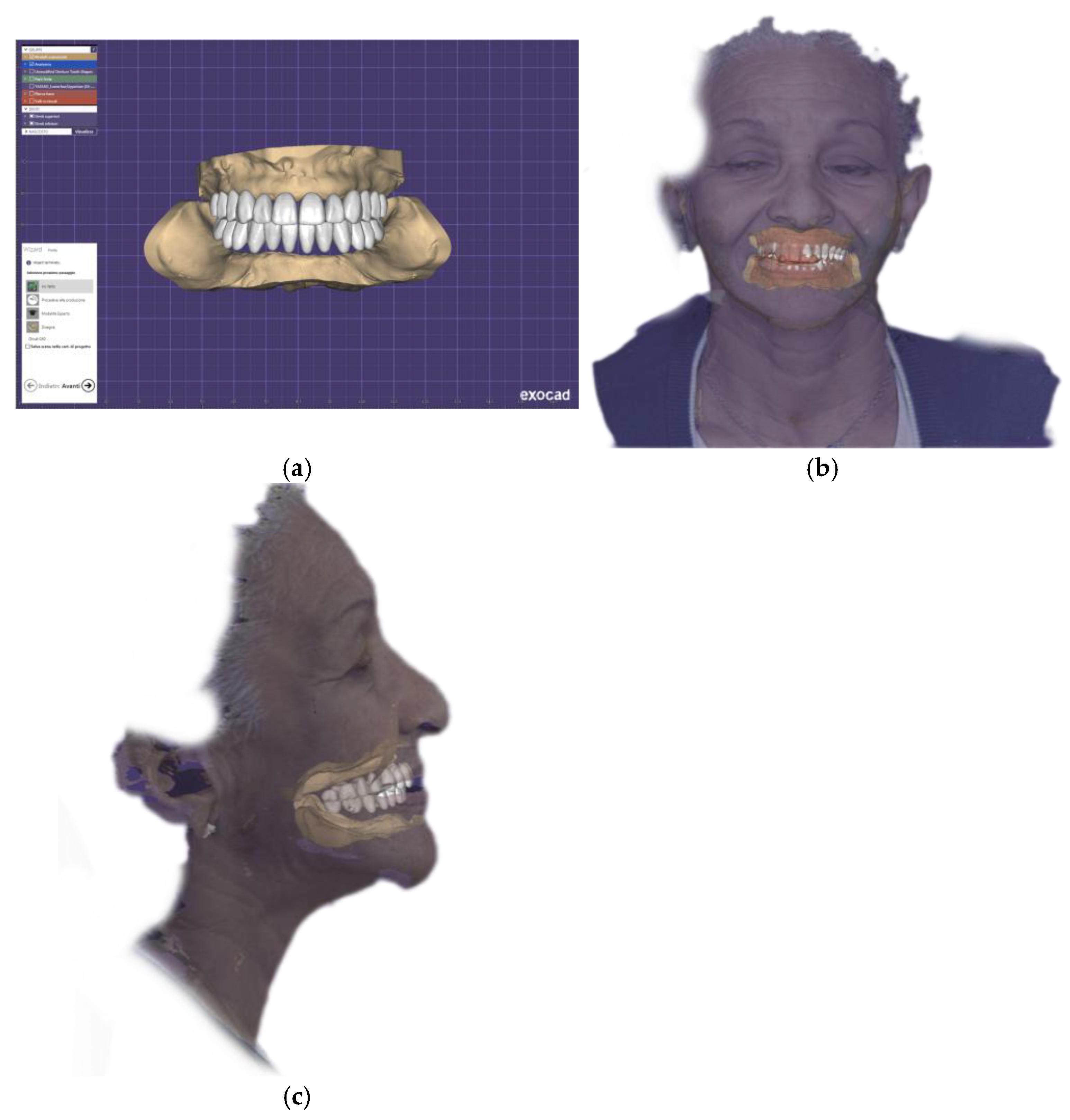 Preprints 163153 g006