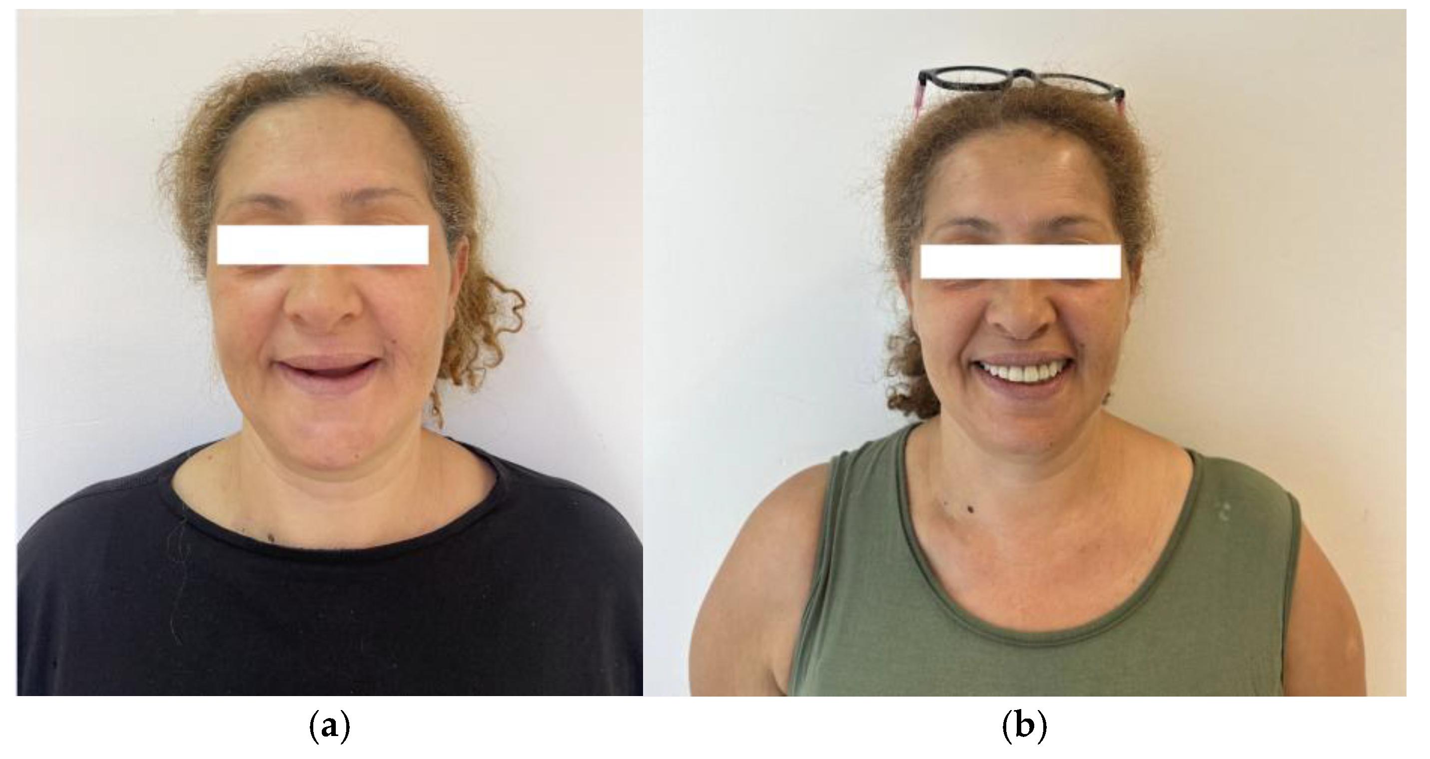 Preprints 163153 g009