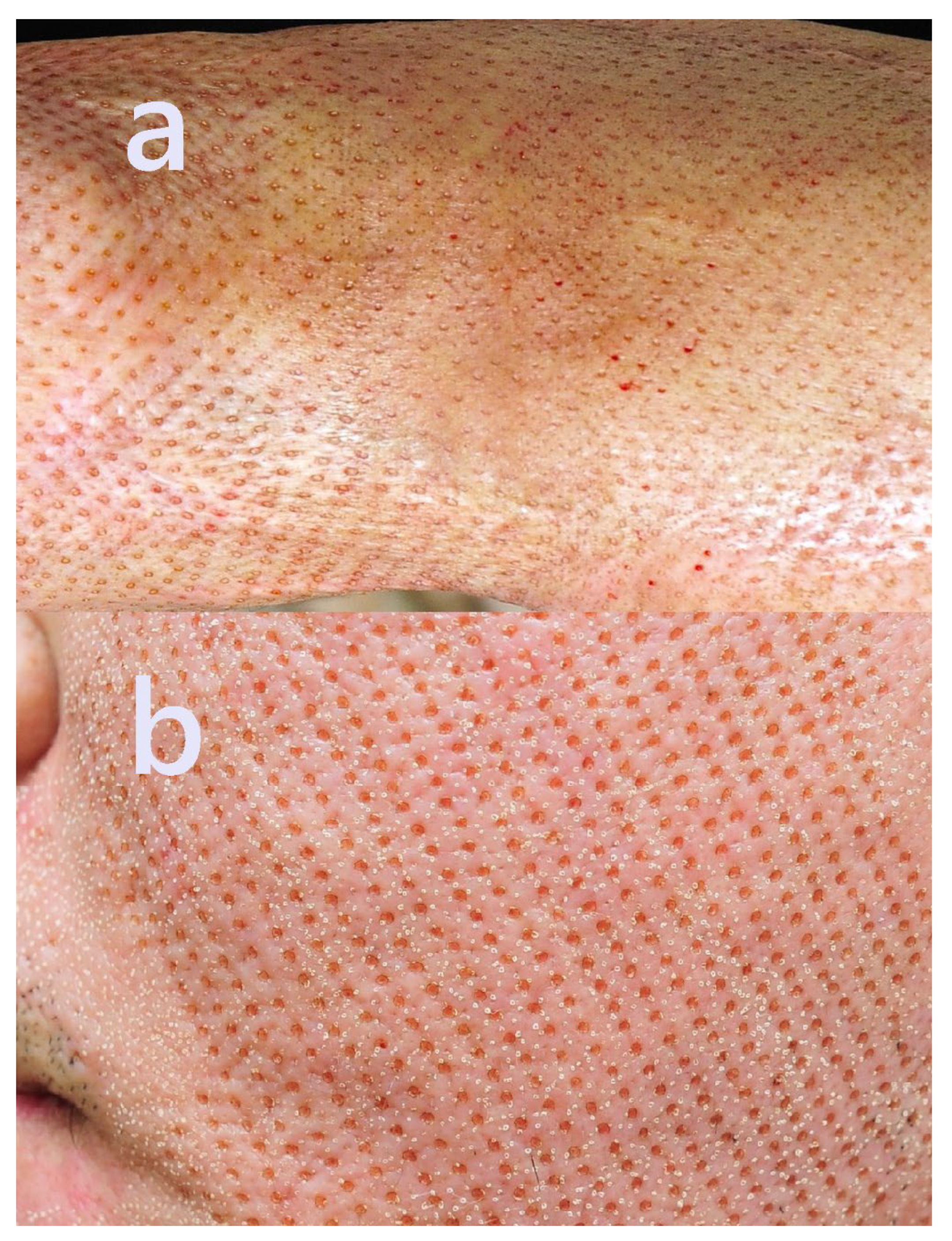 Preprints 172385 g001