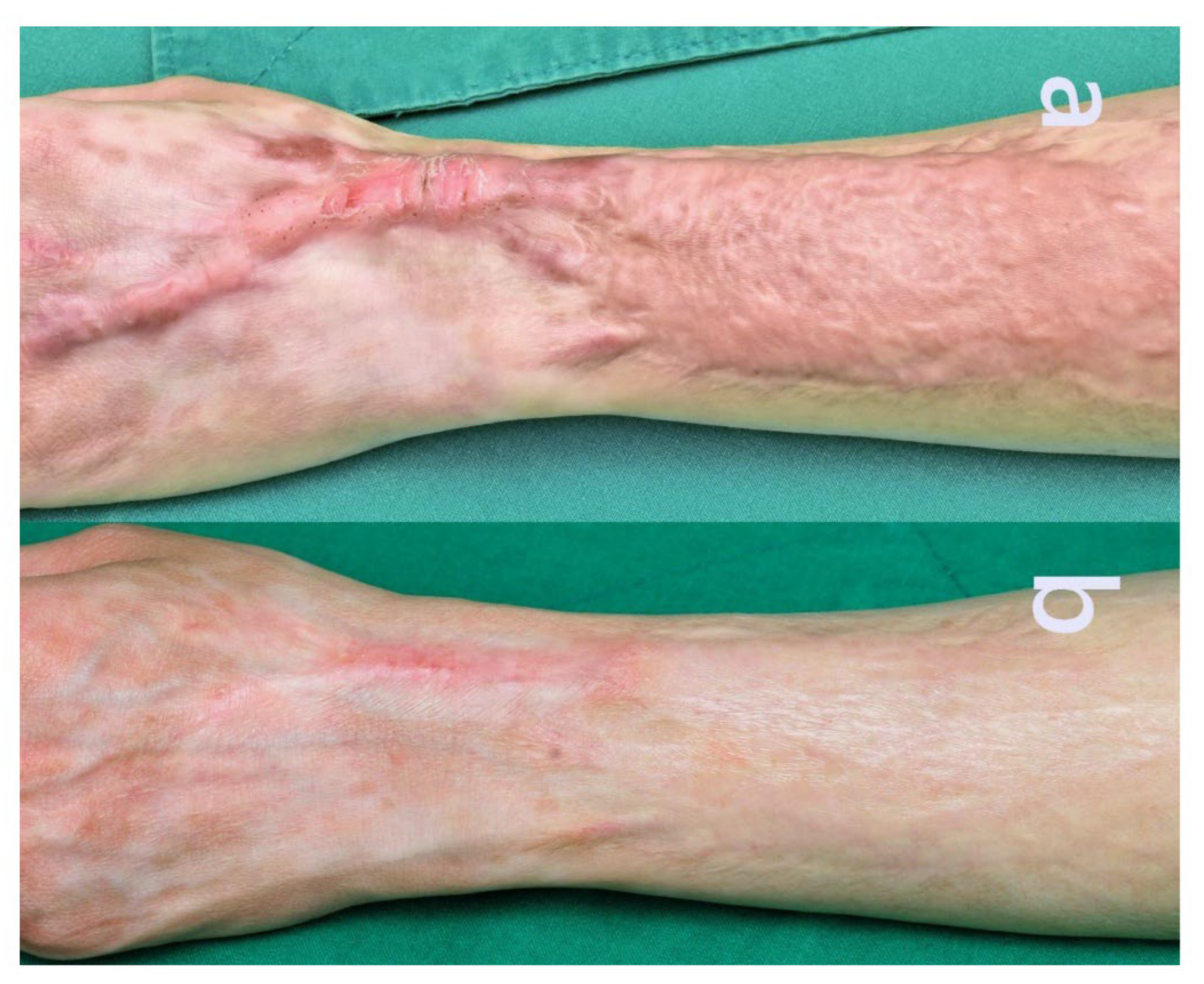 Preprints 172385 g004