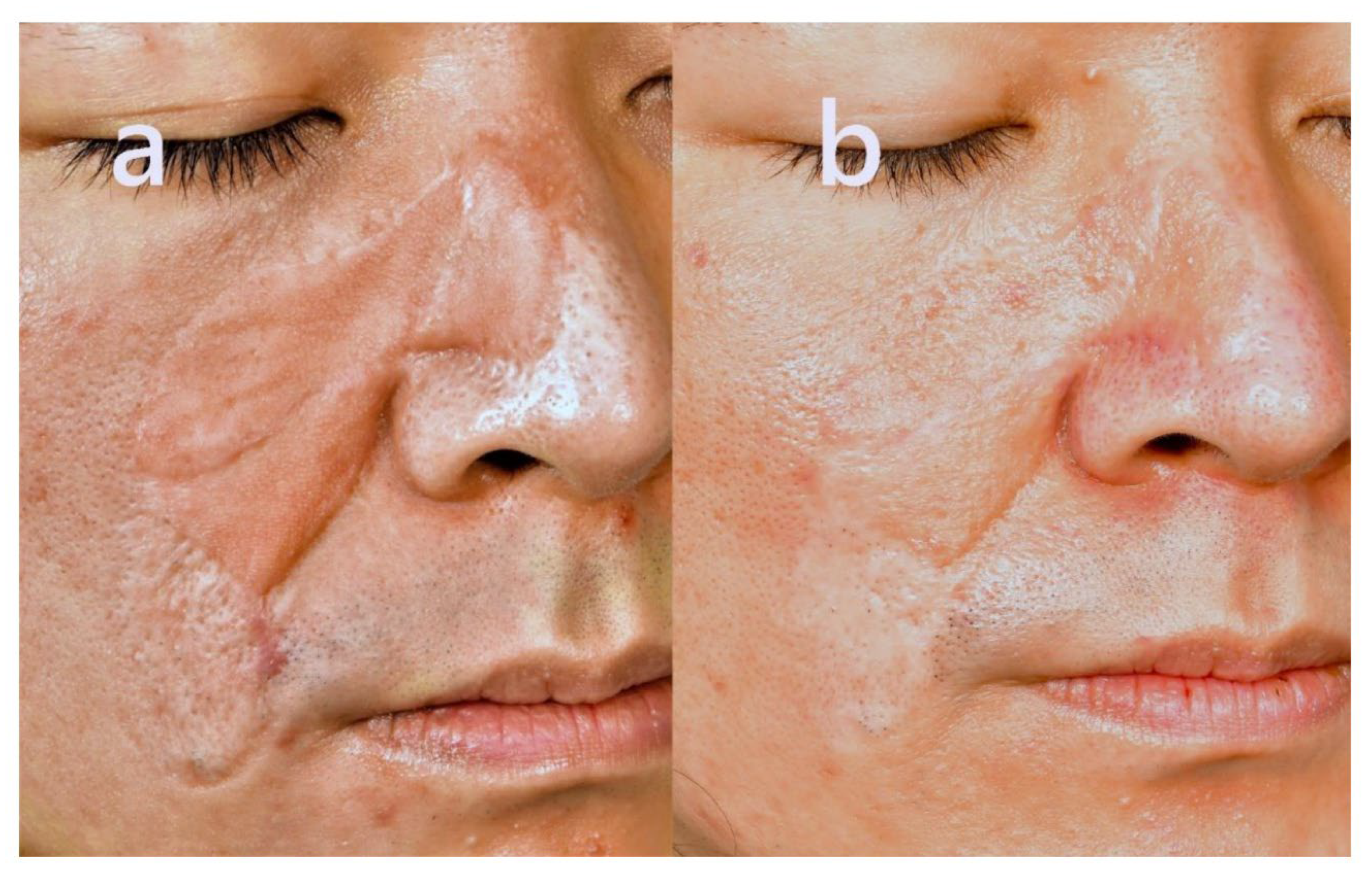 Preprints 172385 g005