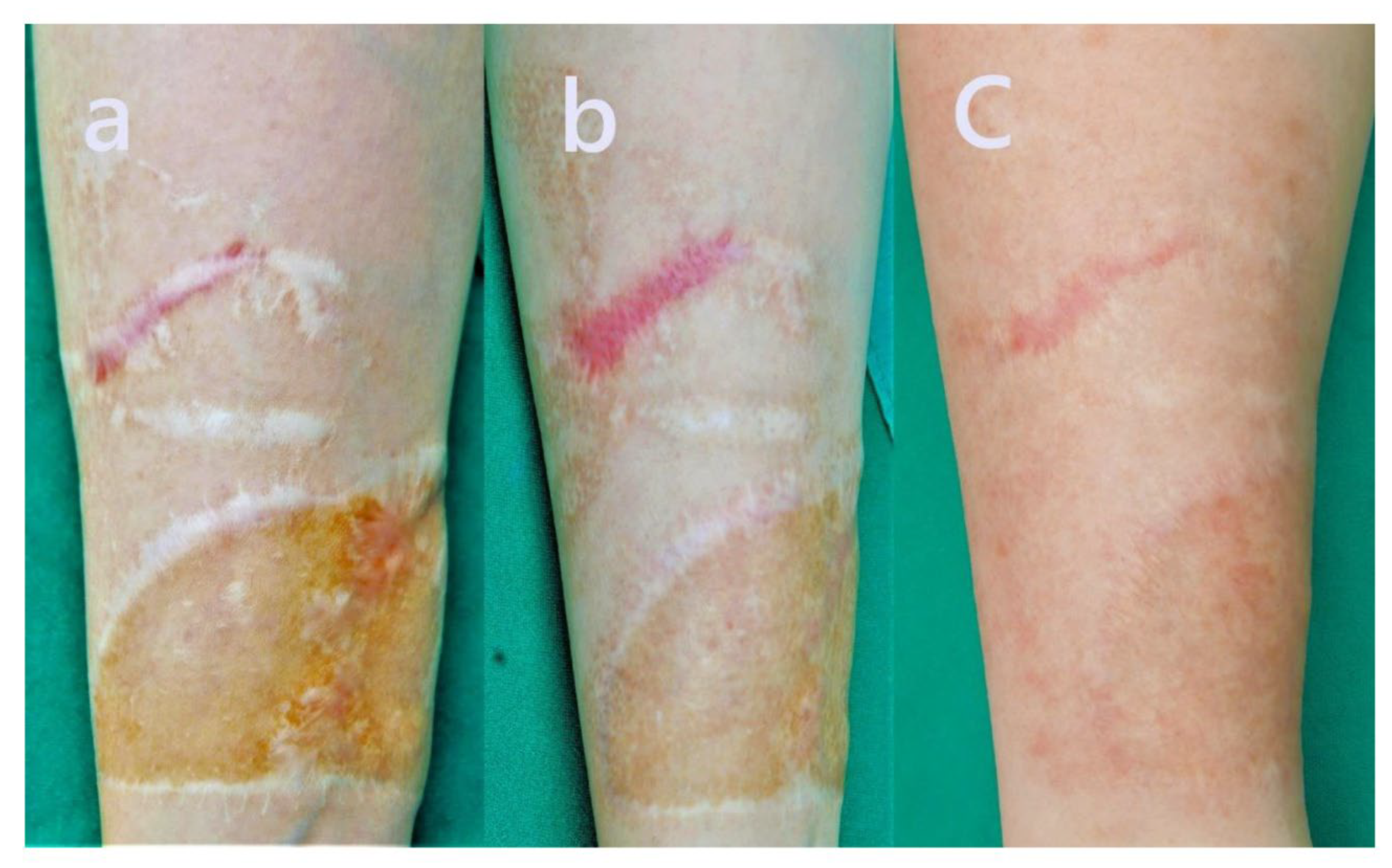 Preprints 172385 g006