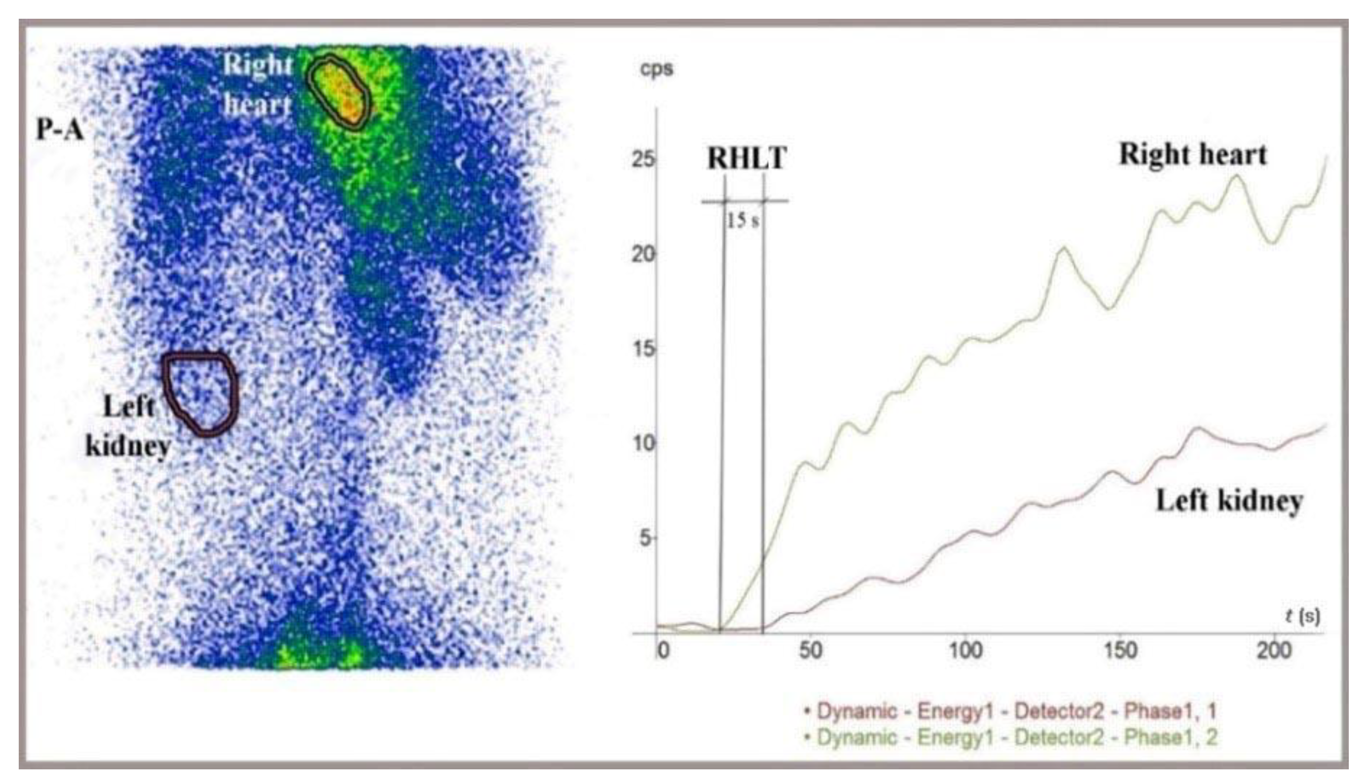 Preprints 168328 g005