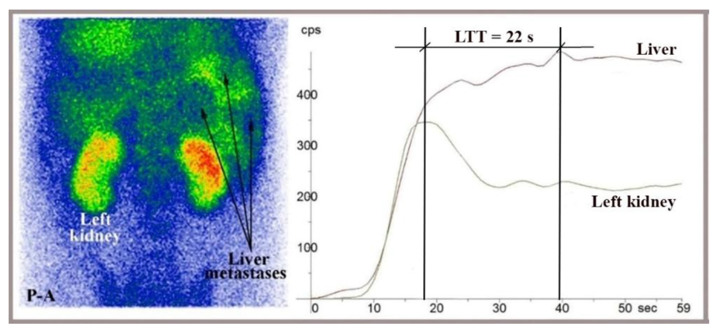 Preprints 168328 g006