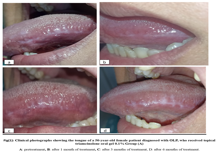 Preprints 191604 i004