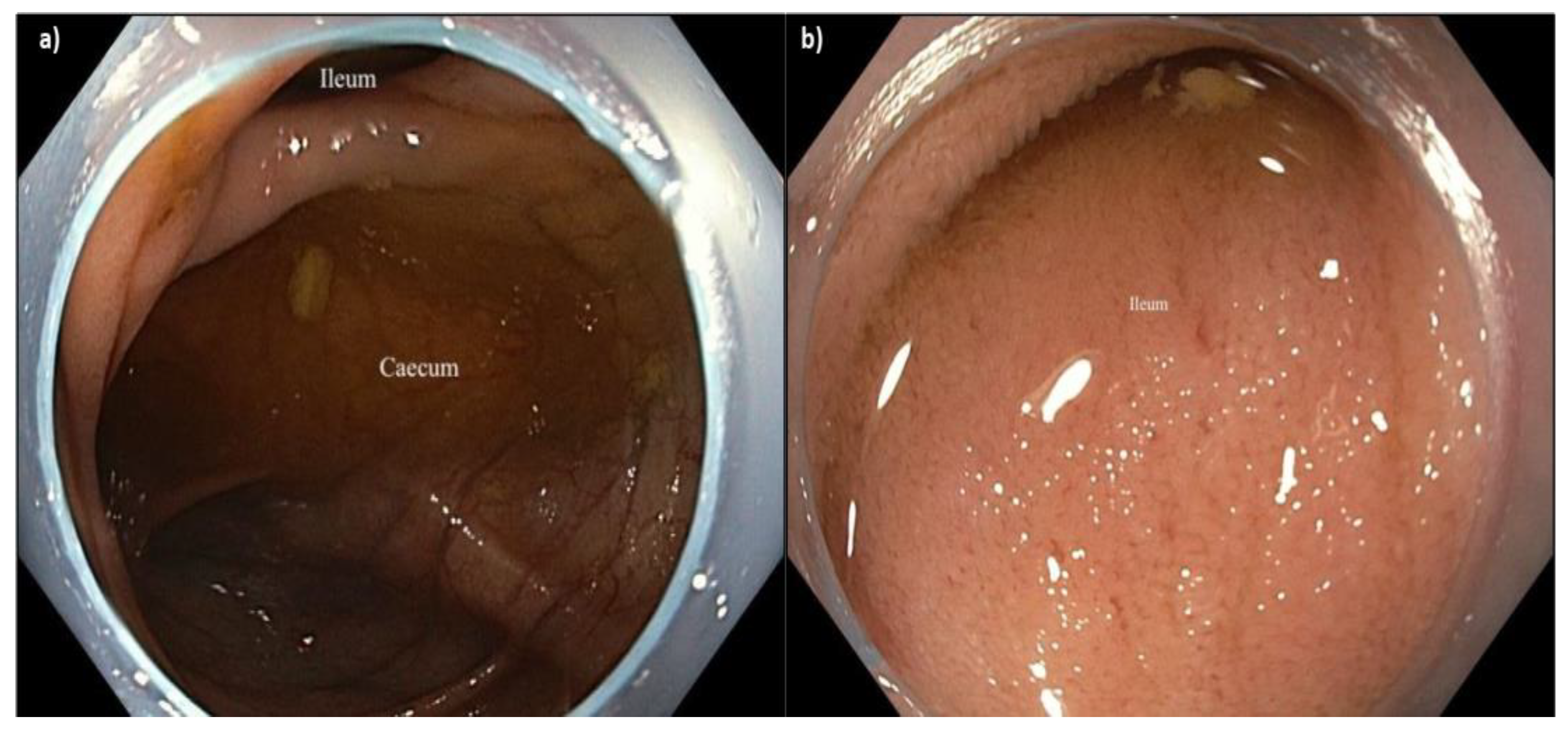 Preprints 151737 g003