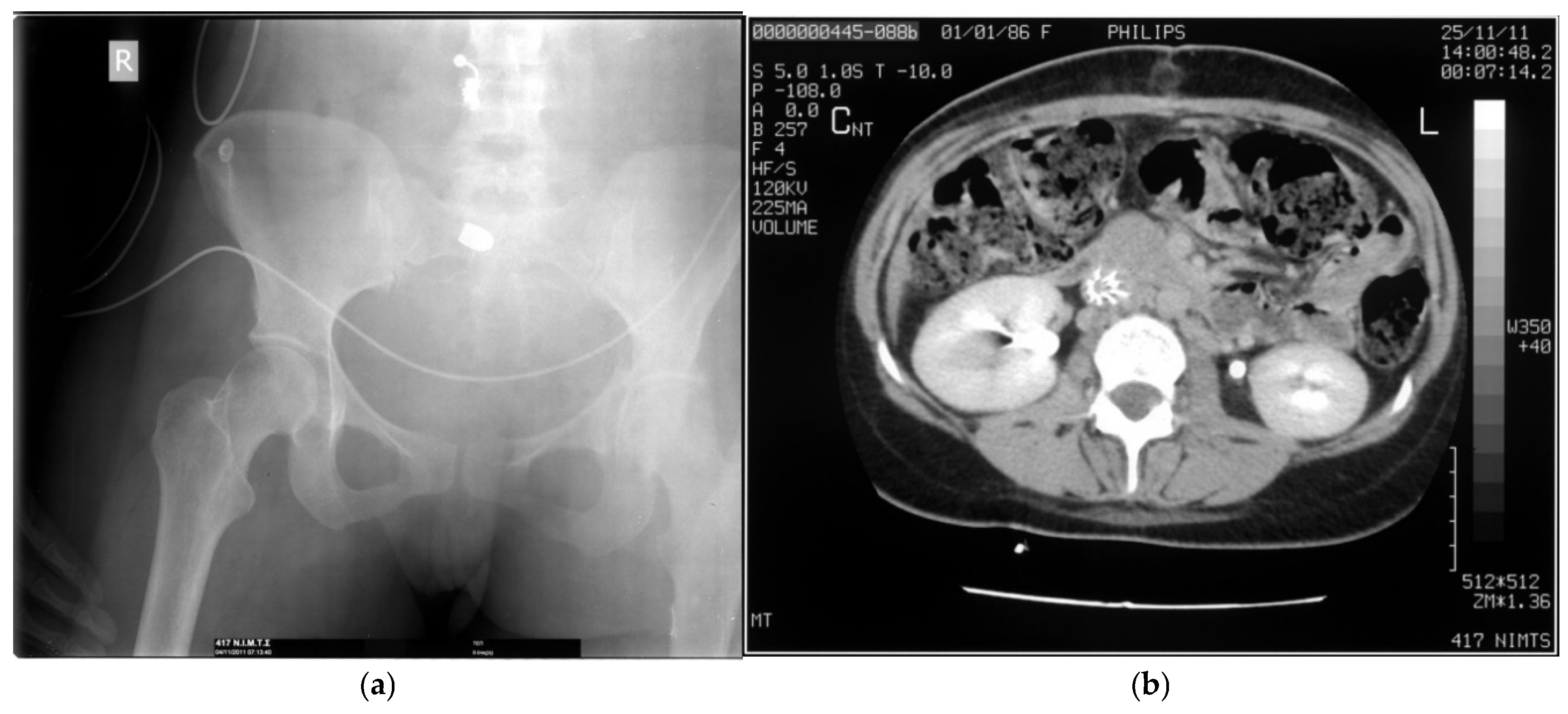 Preprints 170125 g003