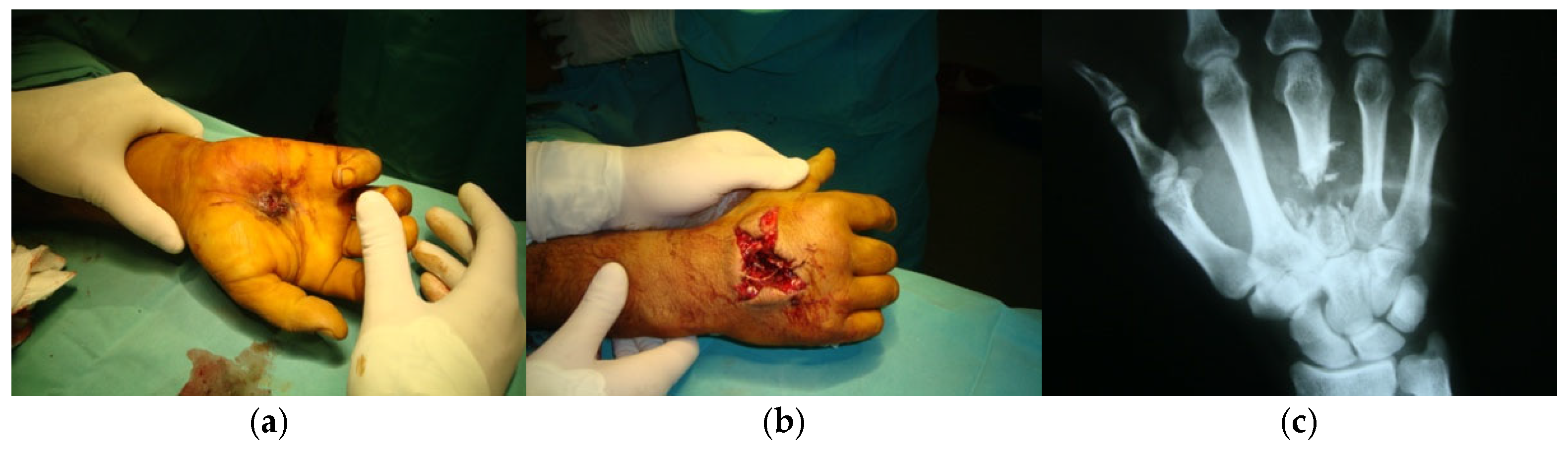 Preprints 170125 g006