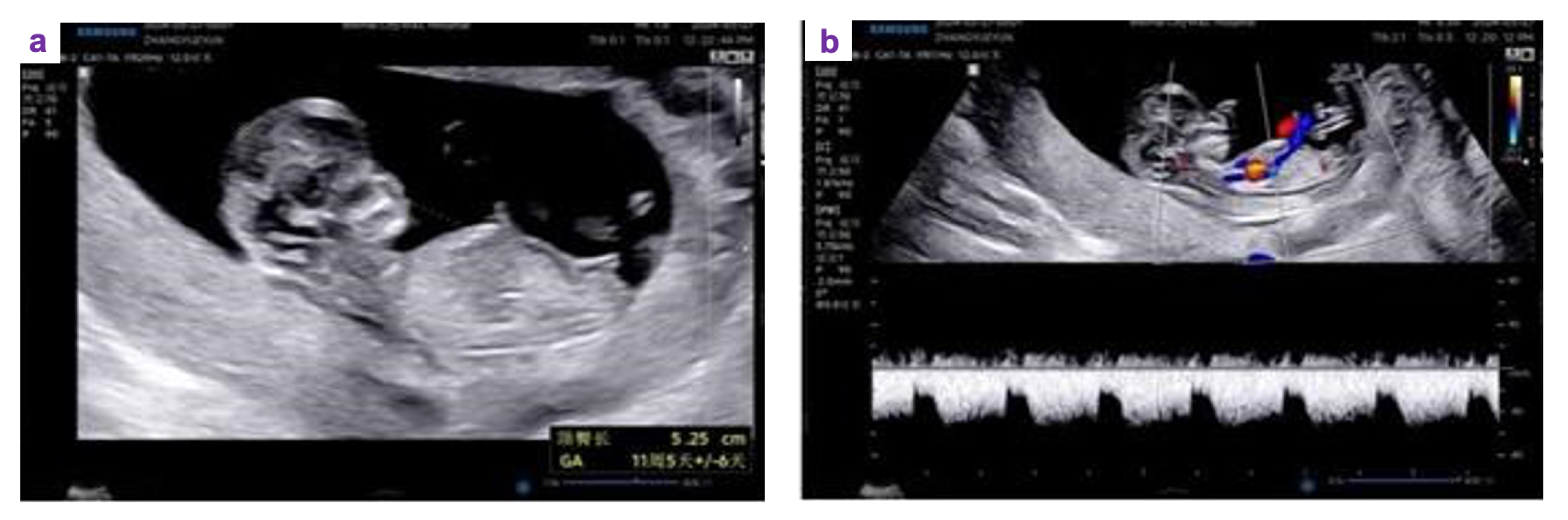 Preprints 182400 g003