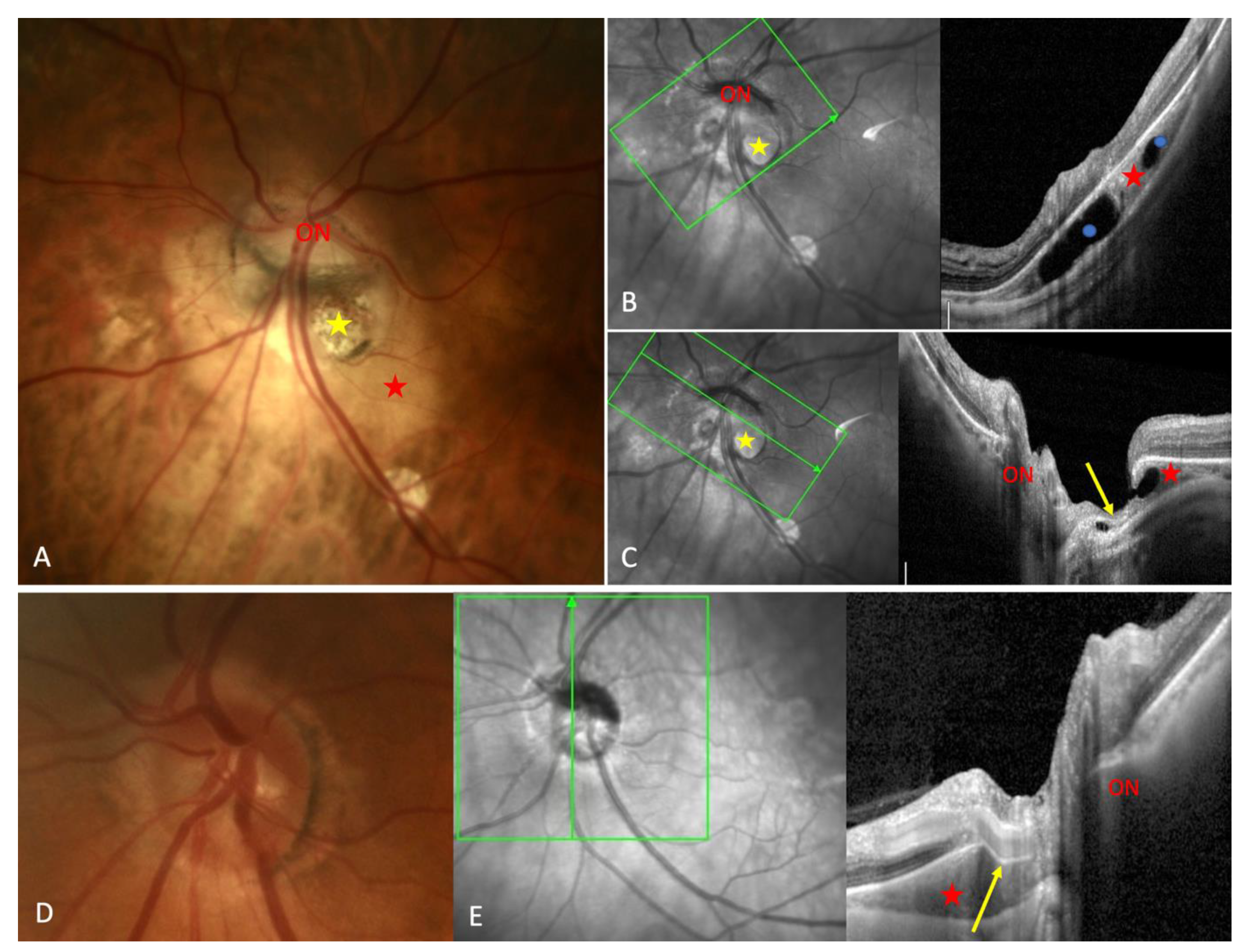 Preprints 73448 g004
