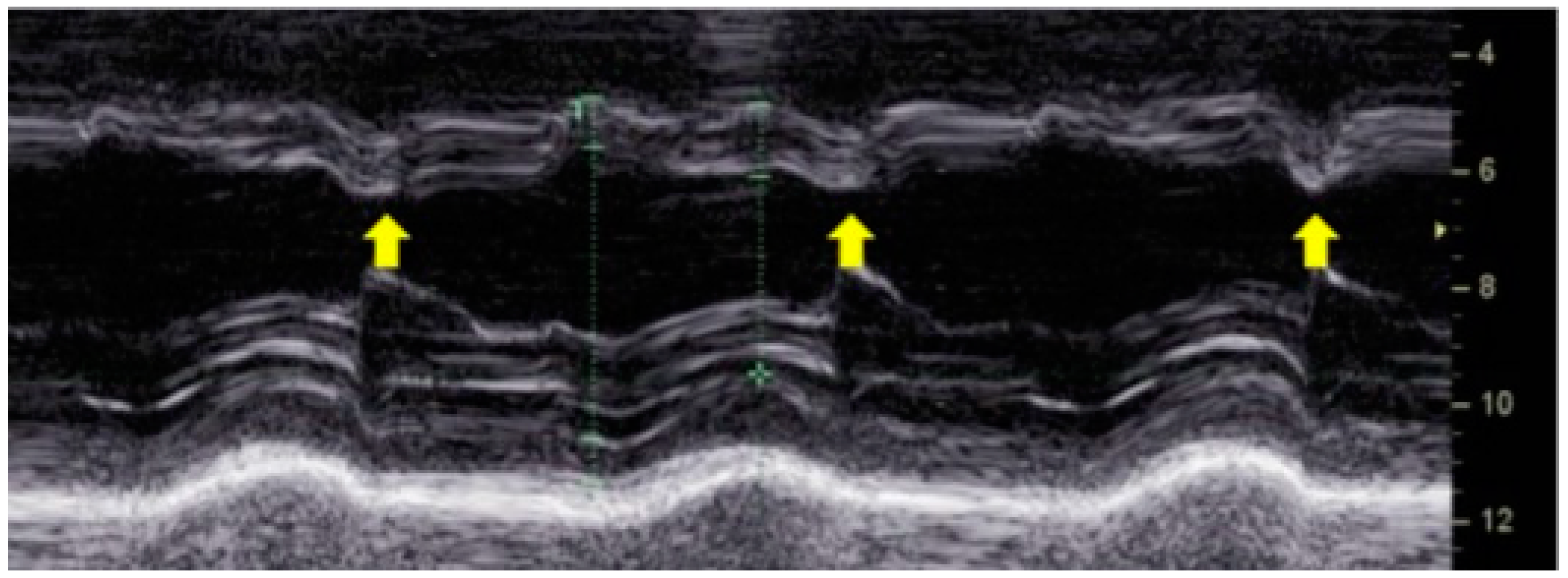 Preprints 149385 g003