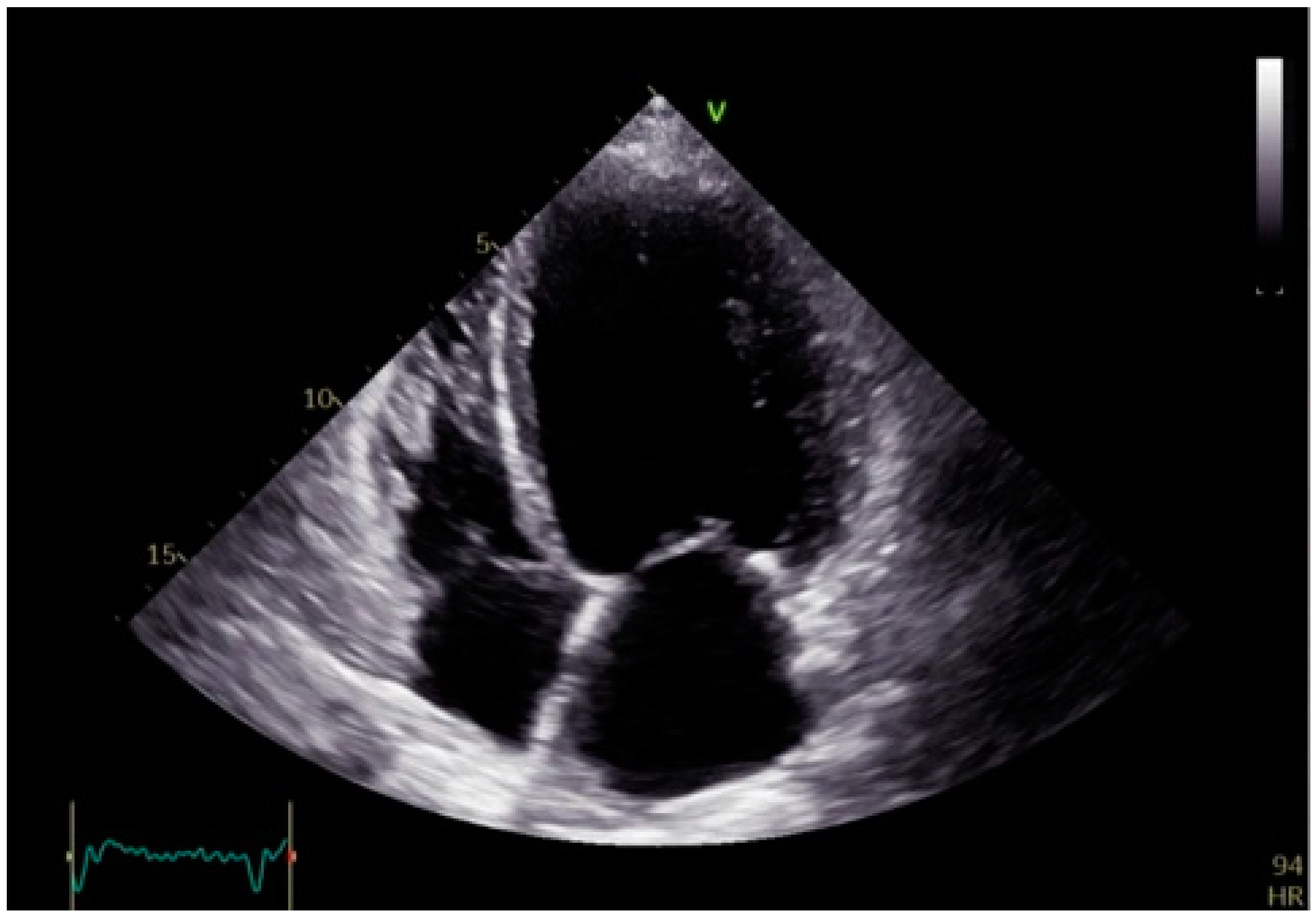 Preprints 149385 g004