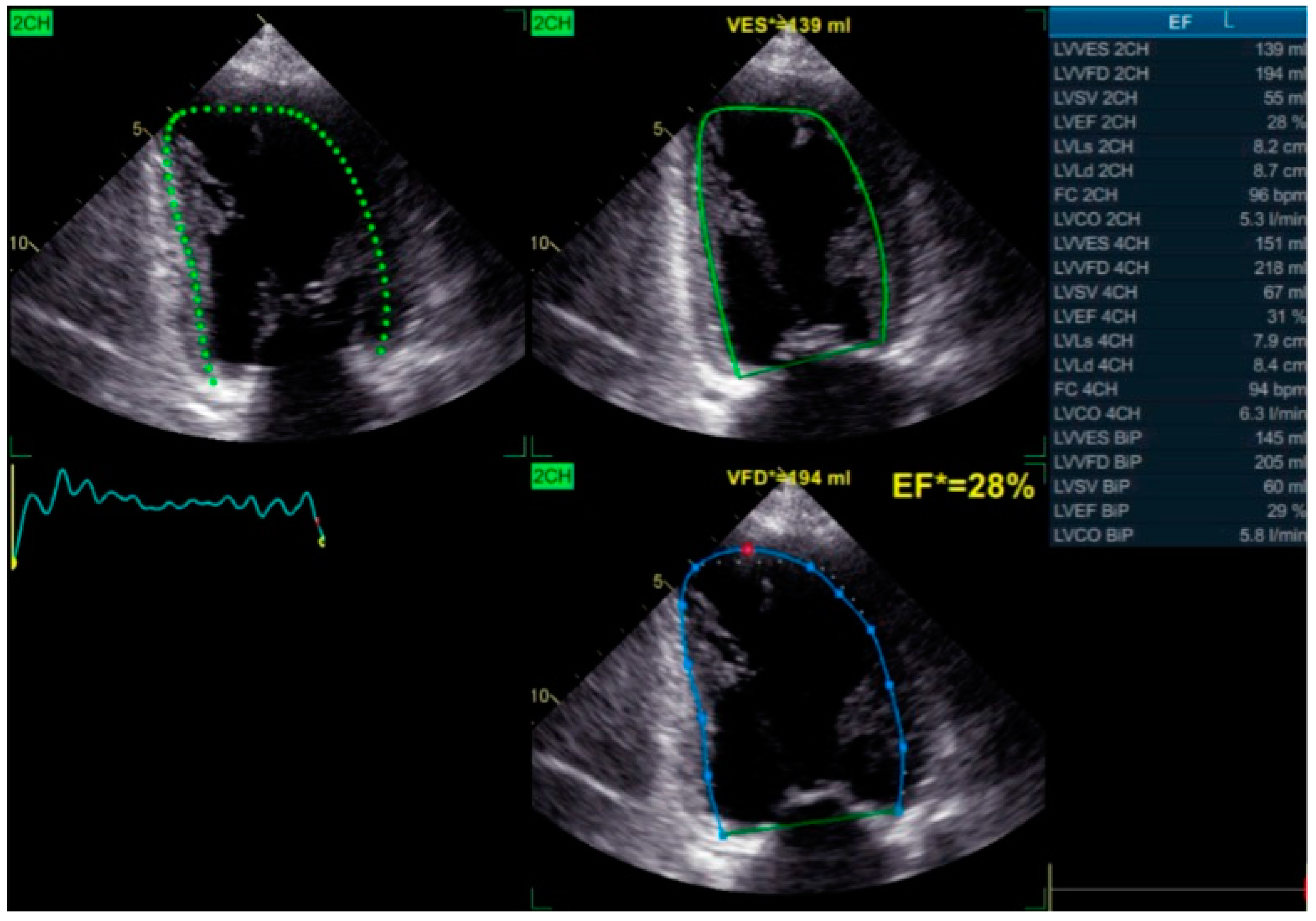 Preprints 149385 g006