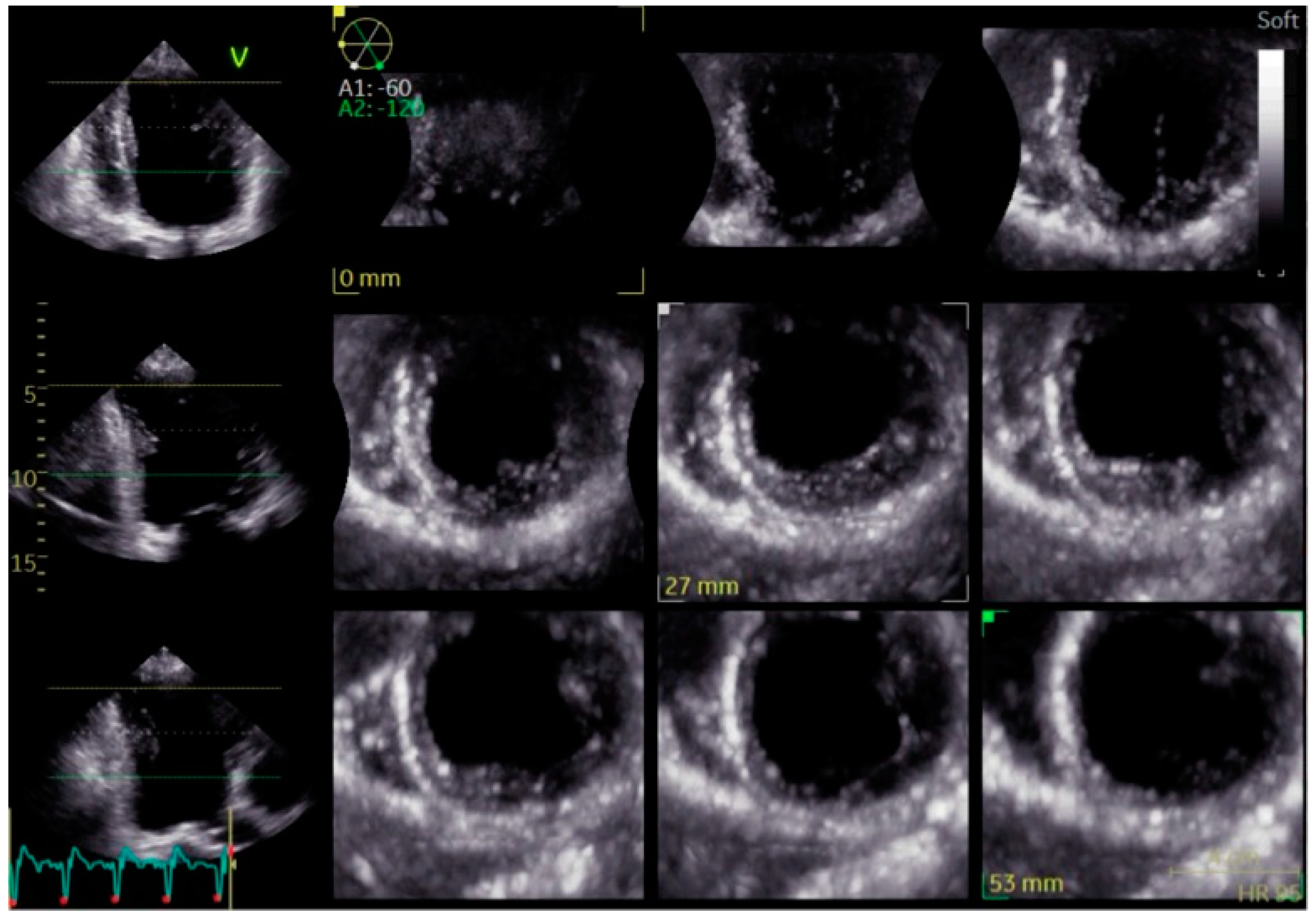 Preprints 149385 g007