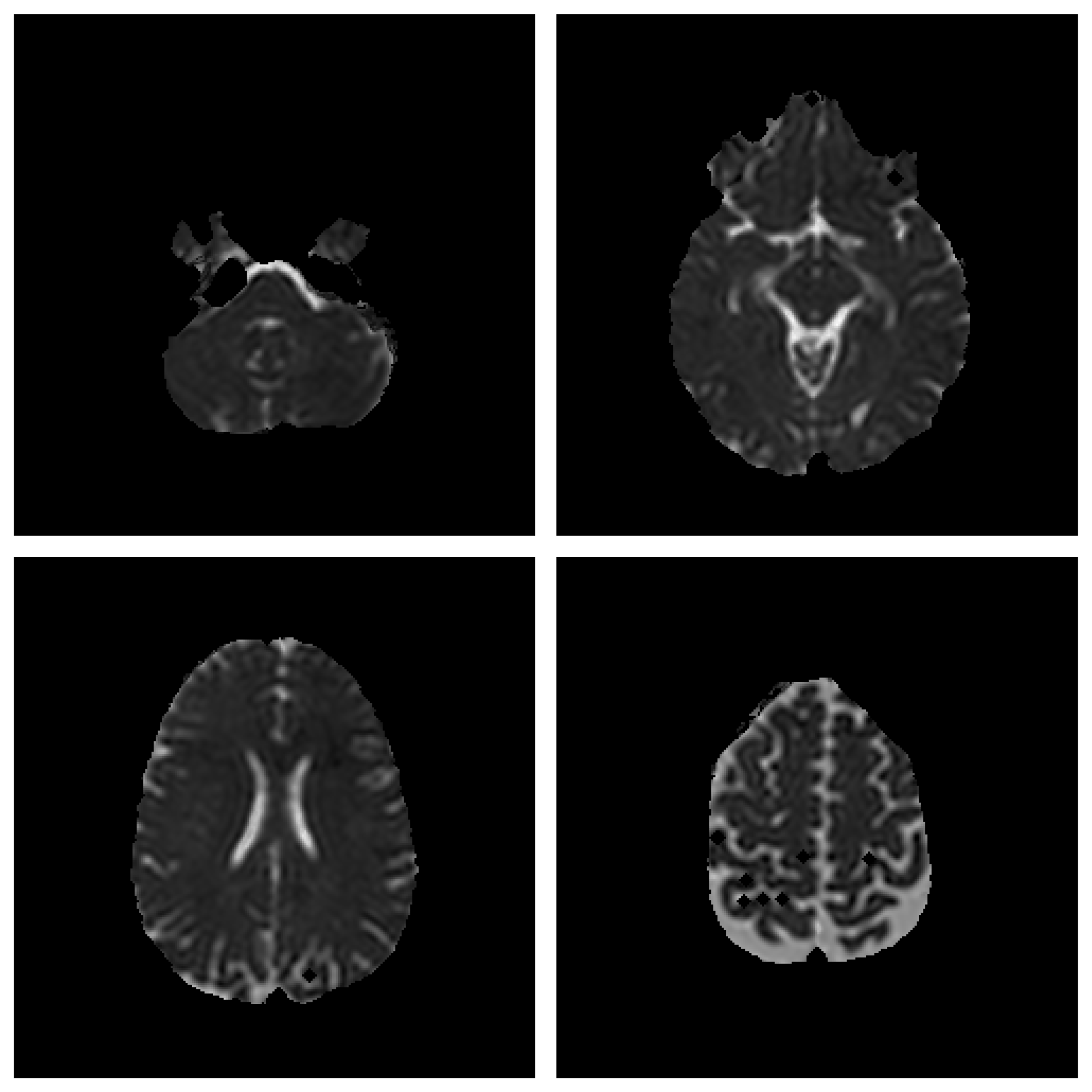 Preprints 165346 g004