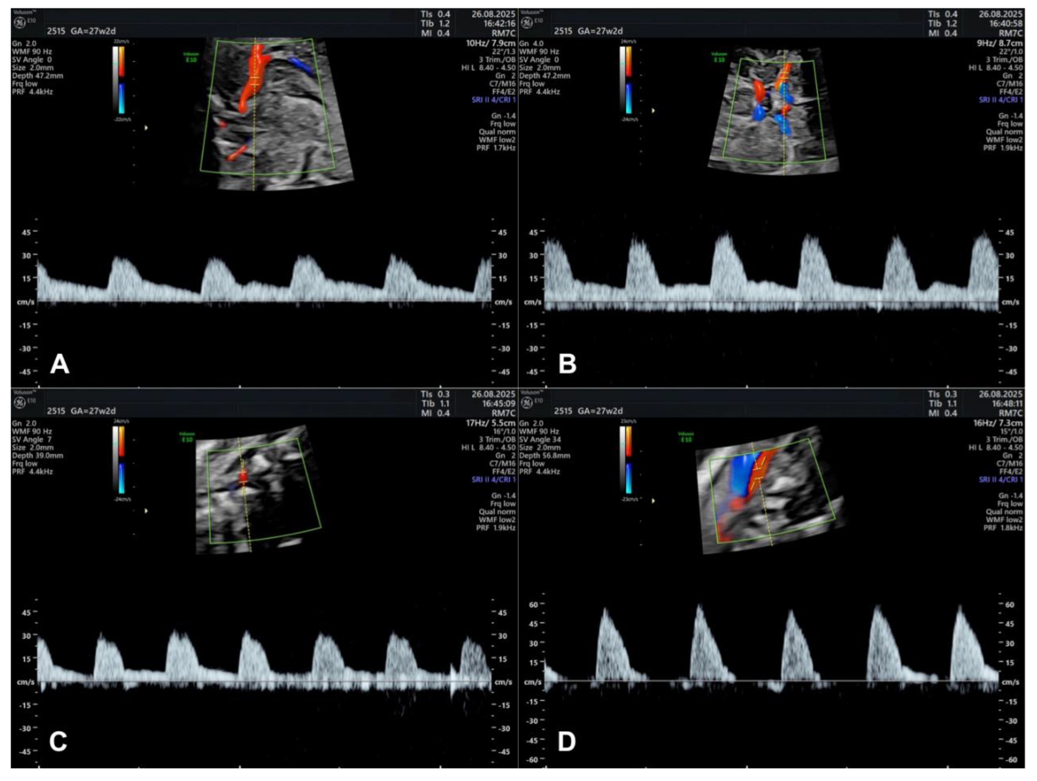 Preprints 175989 g004