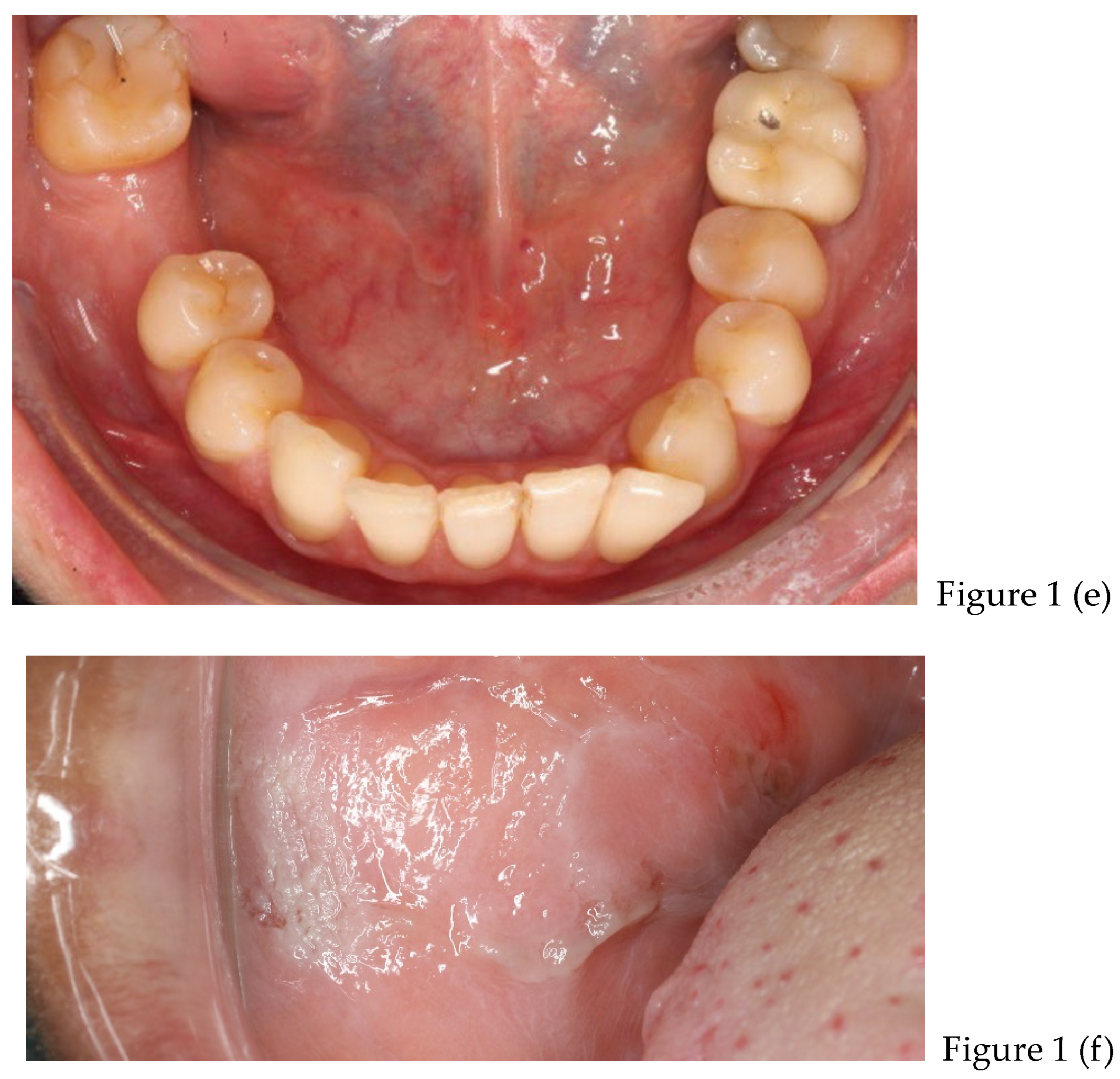 Preprints 168889 g001b