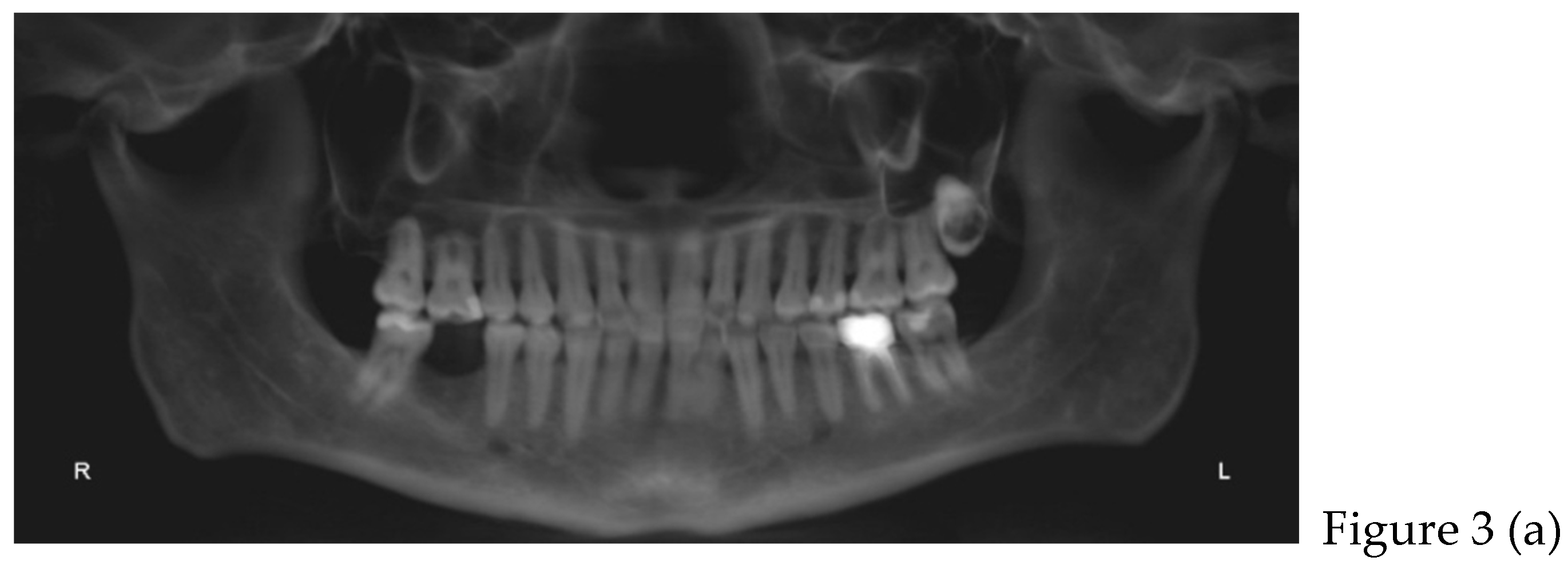 Preprints 168889 g003a