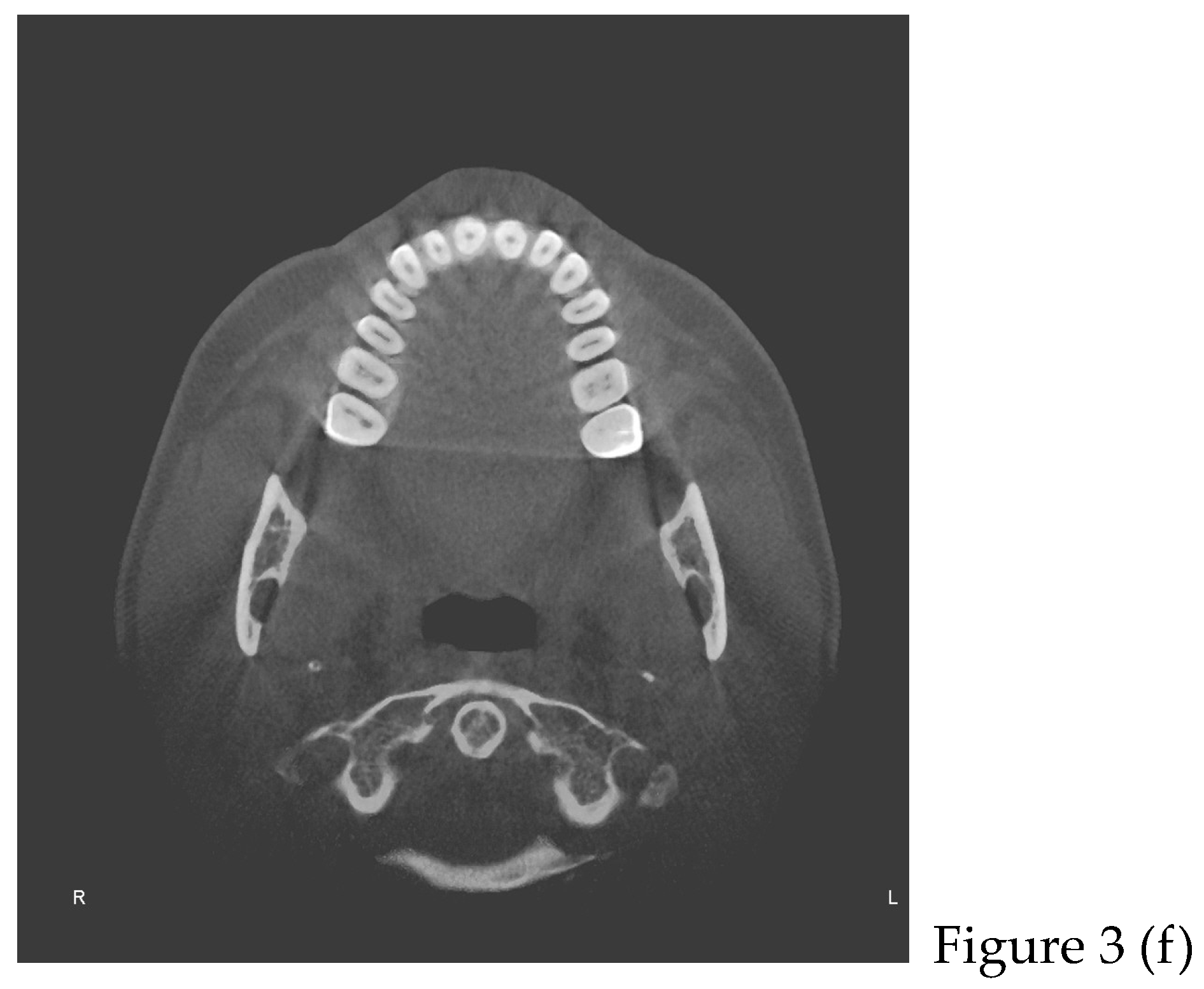 Preprints 168889 g003c