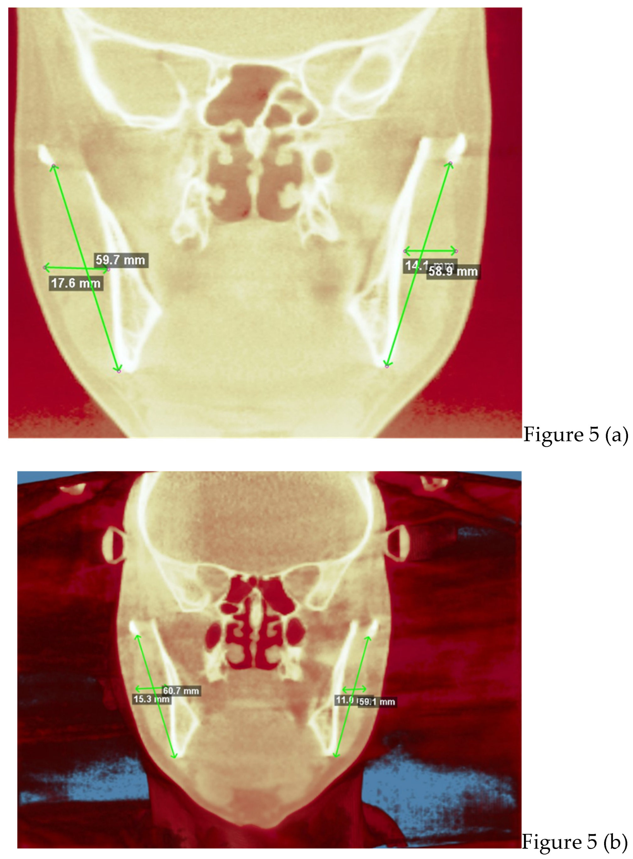 Preprints 168889 g005