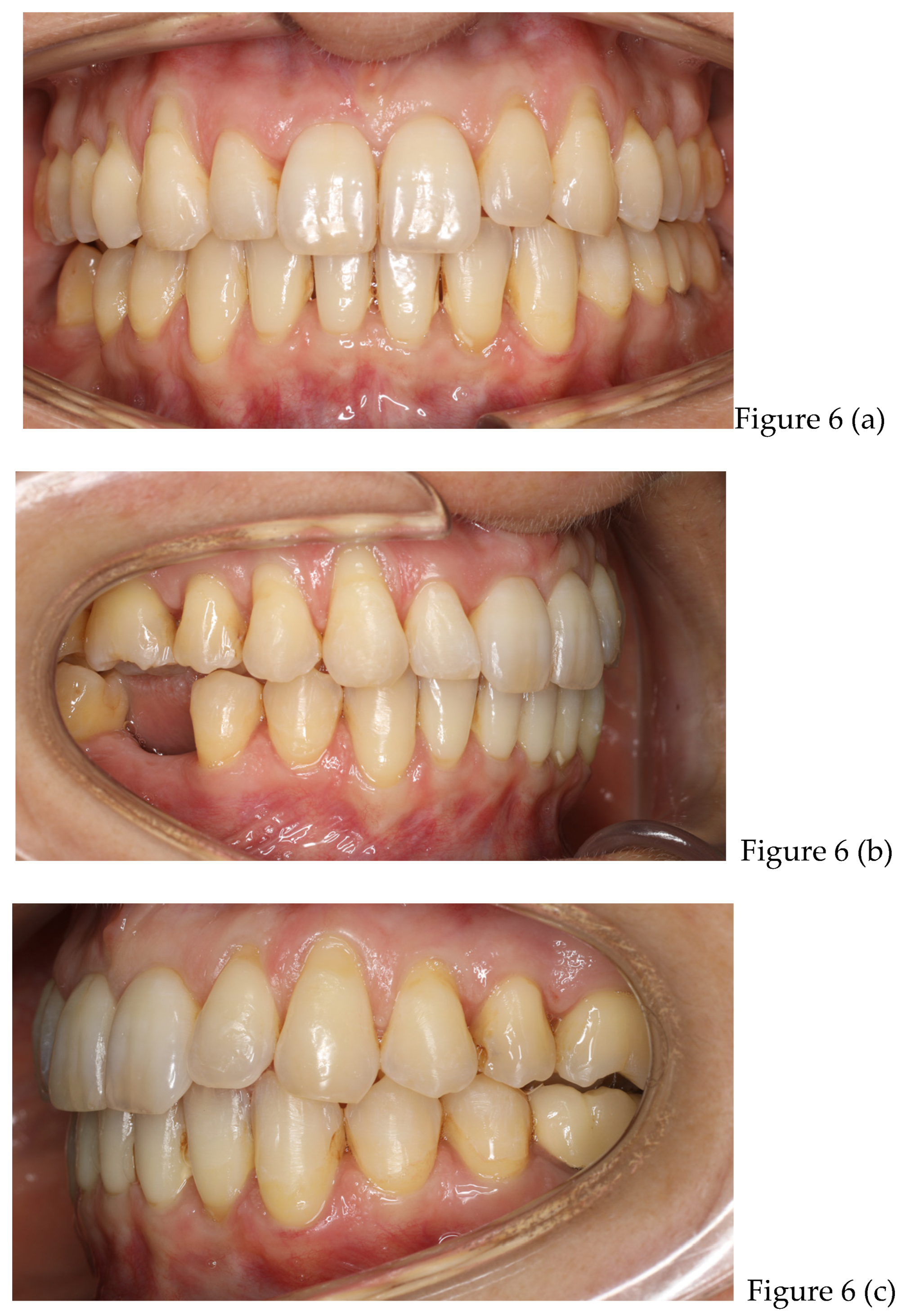 Preprints 168889 g006a