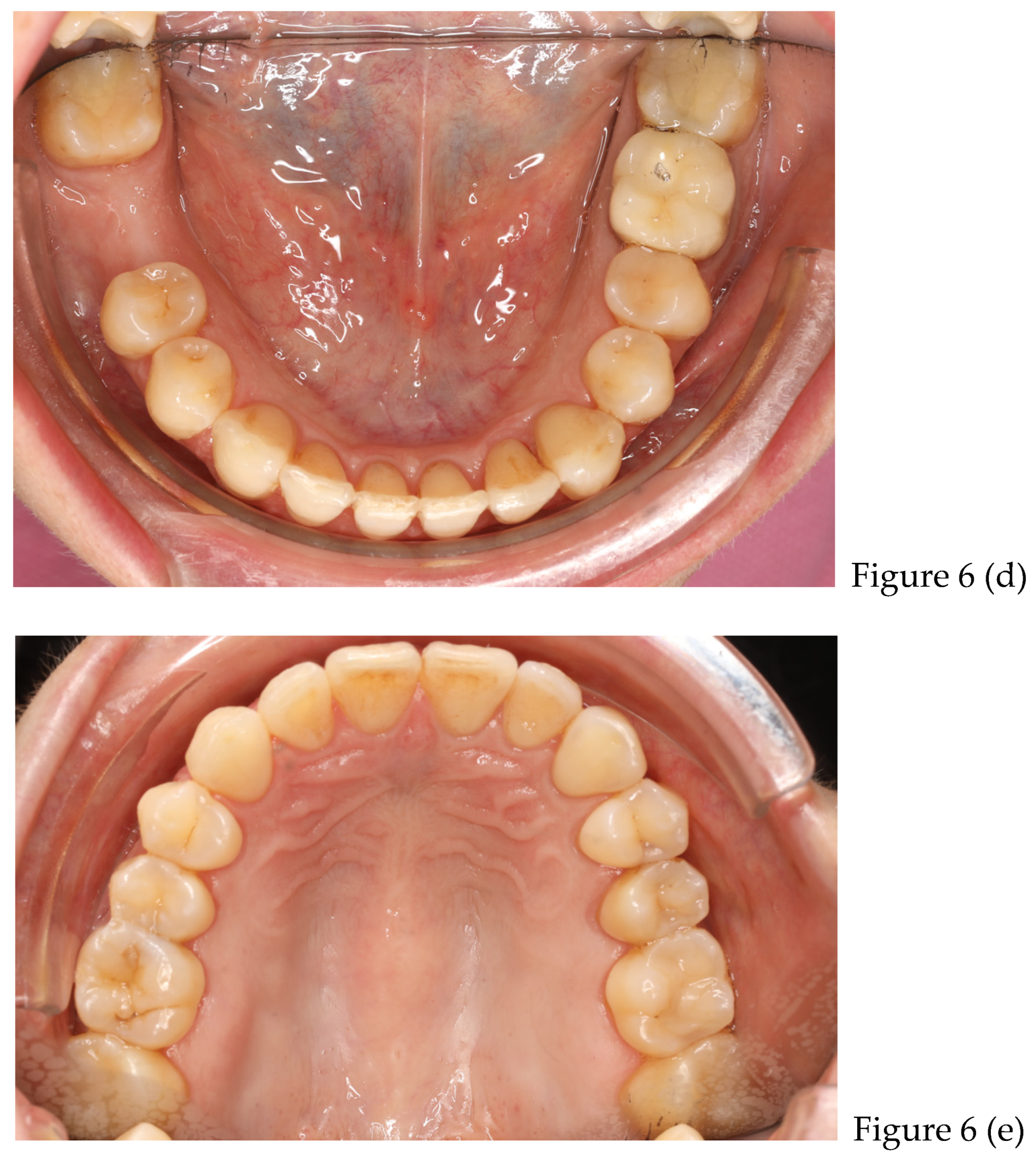 Preprints 168889 g006b