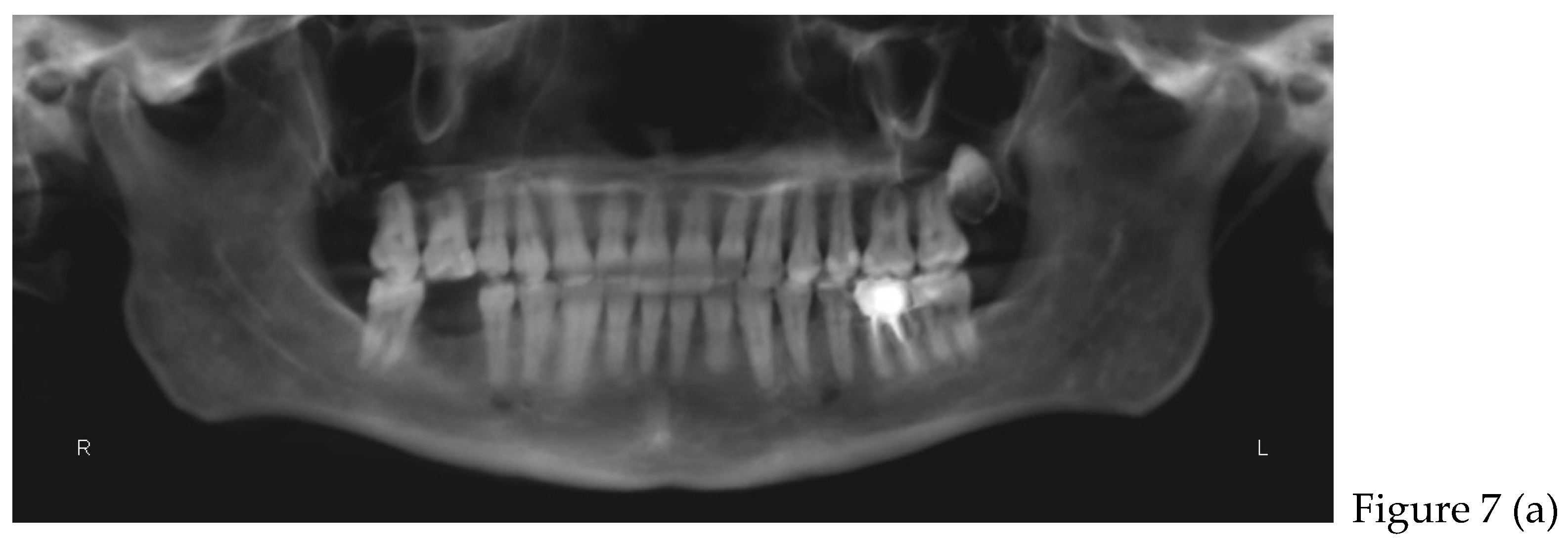 Preprints 168889 g007a